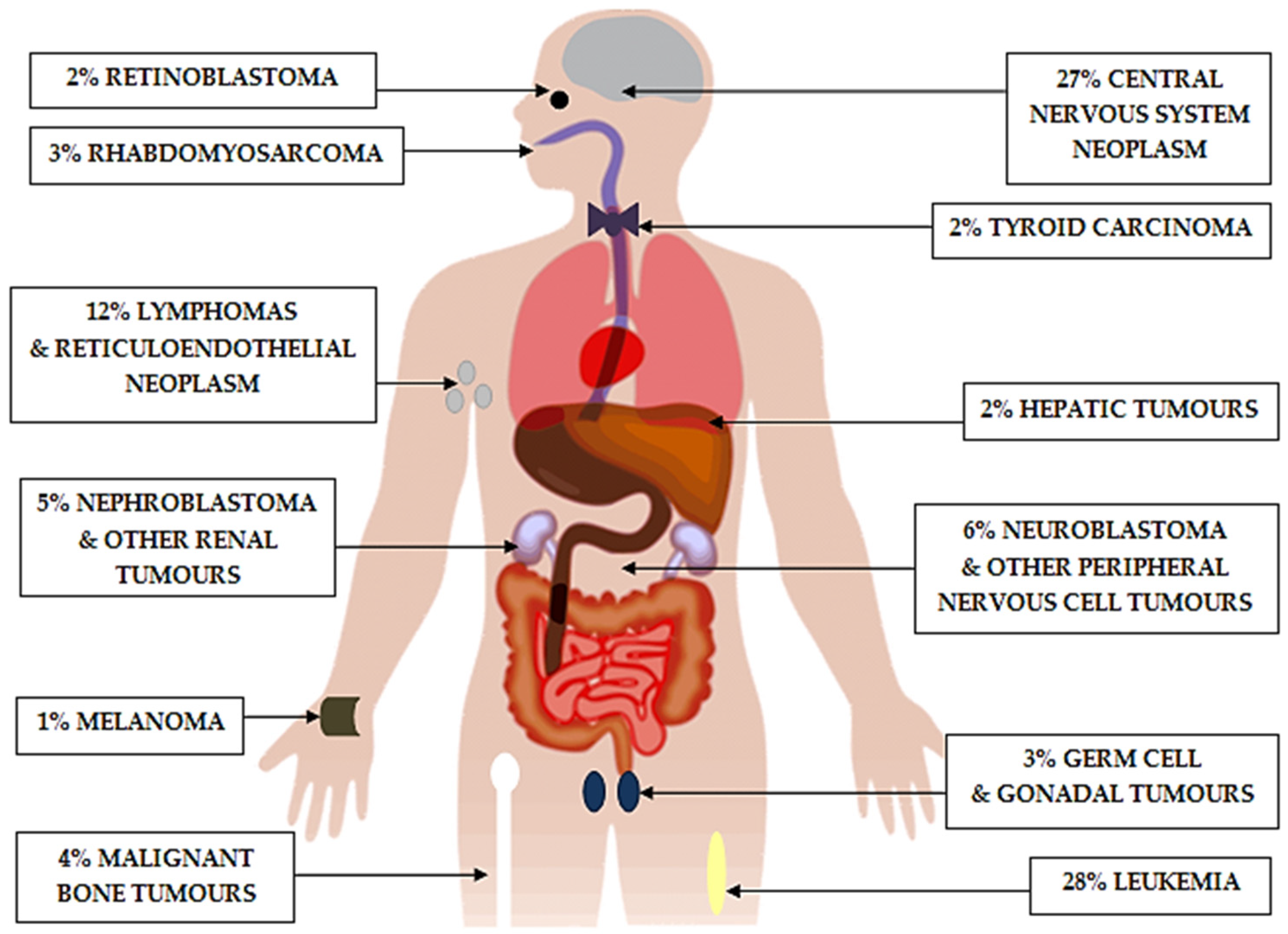 Ijms Free Full Text The Use Of Inhibitors Of Tyrosine Kinase In Paediatric Haemato Oncology When And Why Html
