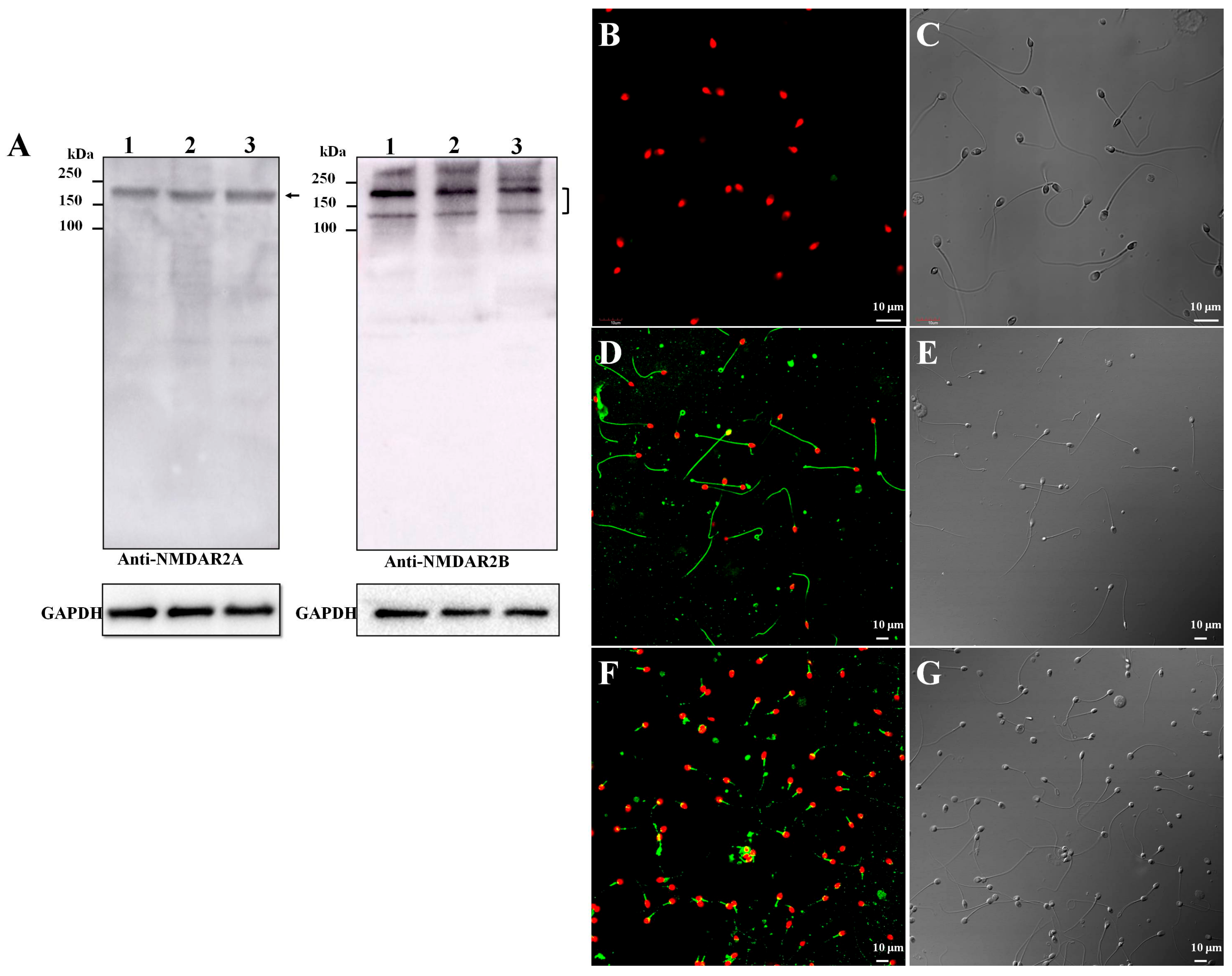 IJMS | Free Full-Text | N-Methyl-d-aspartic Acid (NMDA) Receptor Is  Involved in the Inhibitory Effect of Ketamine on Human Sperm Functions