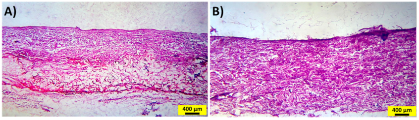 Ijms 22 12479 g006 550