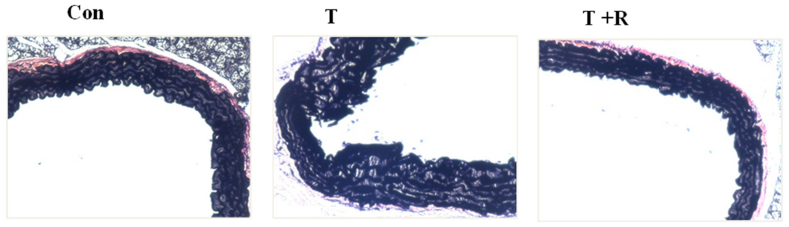 Ijms 22 12486 g006