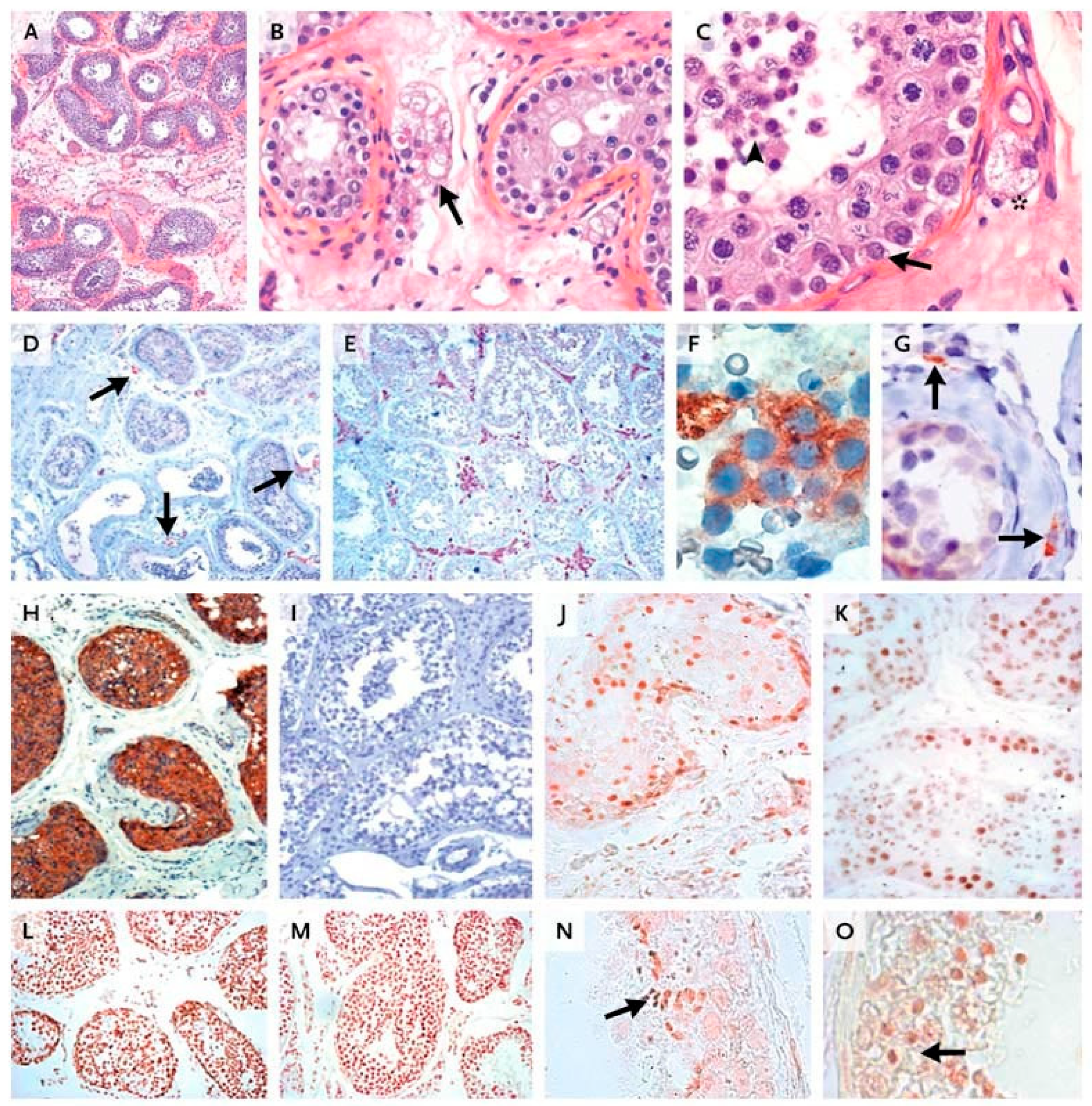 Ijms 22 12735 g004