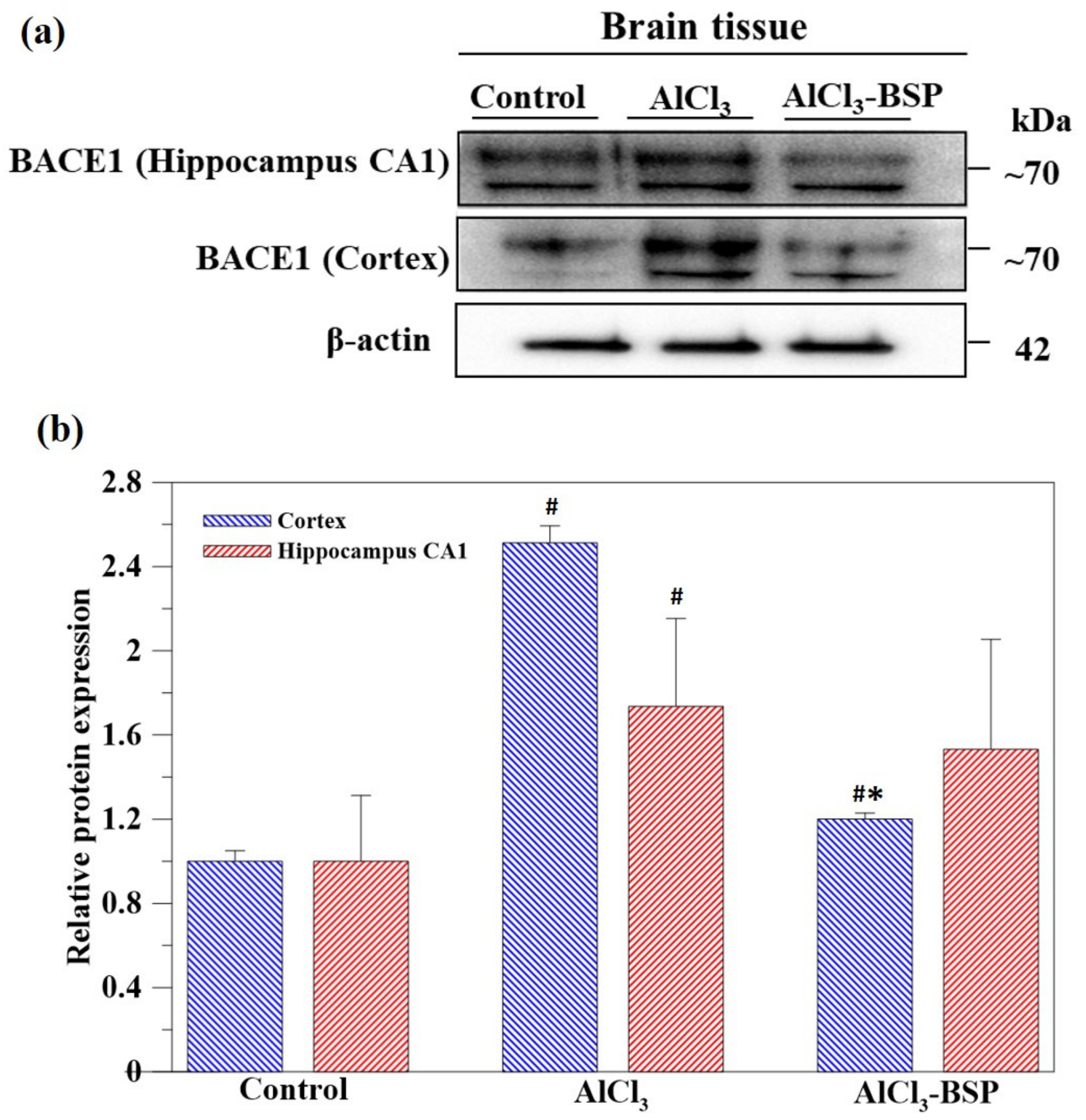 Ijms 22 12760 g009 550