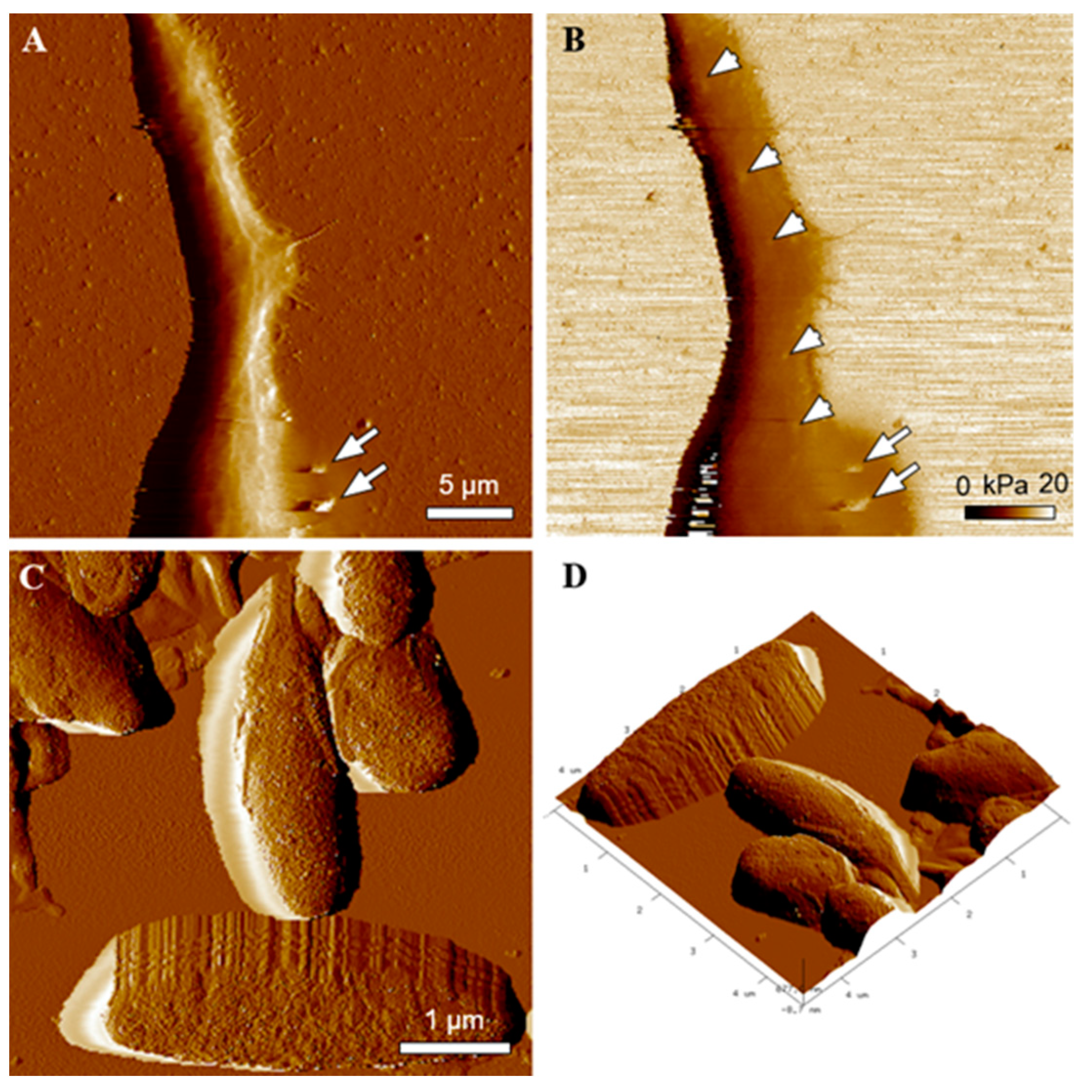 Ijms 22 12787 g007 550