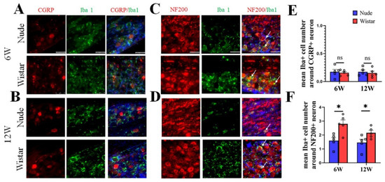 Macrophage Activation in the Dorsal Root Ganglion in Rats Developing Macrophage Activation in the Dorsal Root Ganglion in Rats Developing