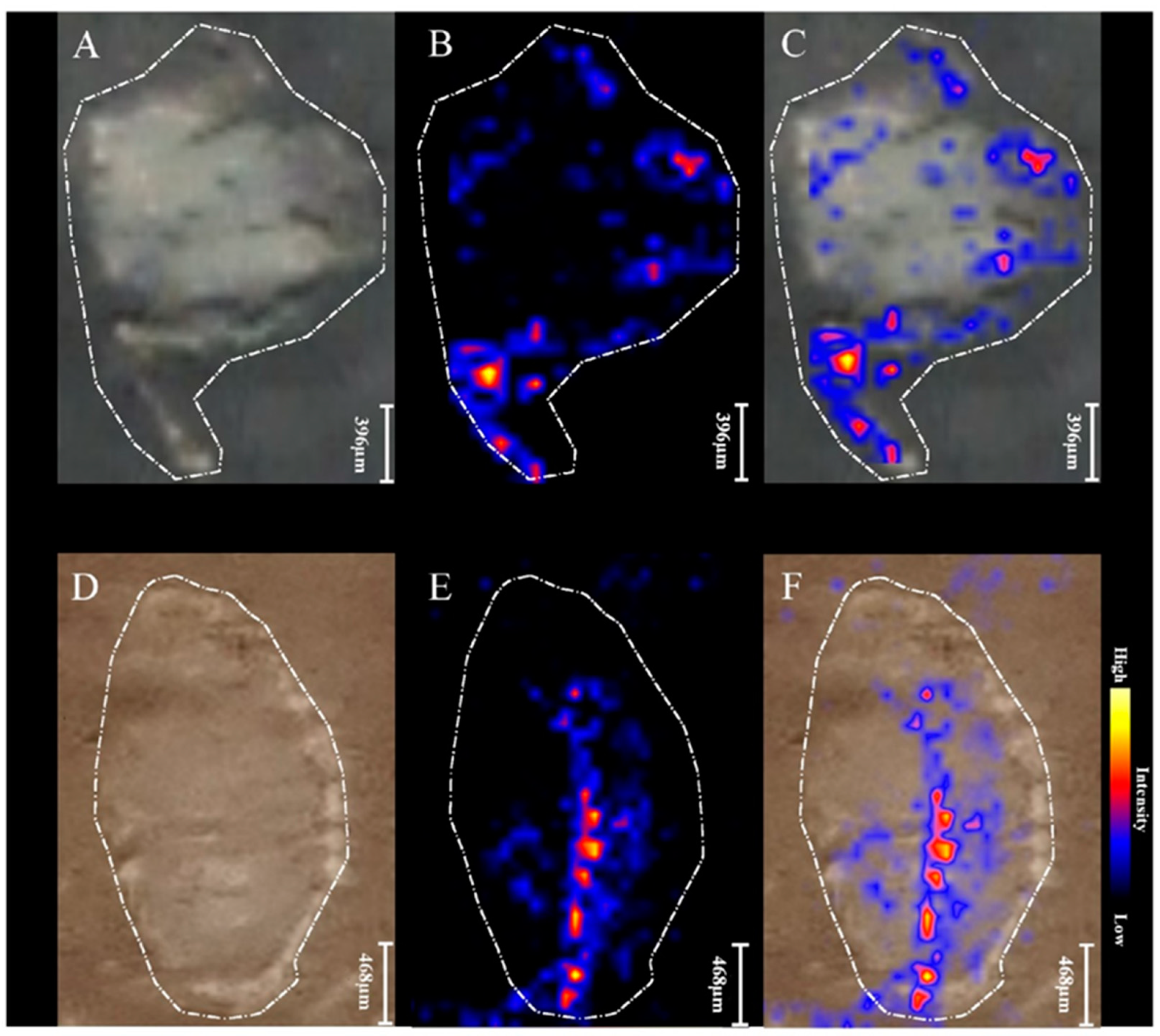 Ijms Free Full Text Multimodal Spectroscopic Imaging Of Pea Root Nodules To Assess The Nitrogen Fixation In The Presence Of Biofertilizer Based On Nod Factors Html