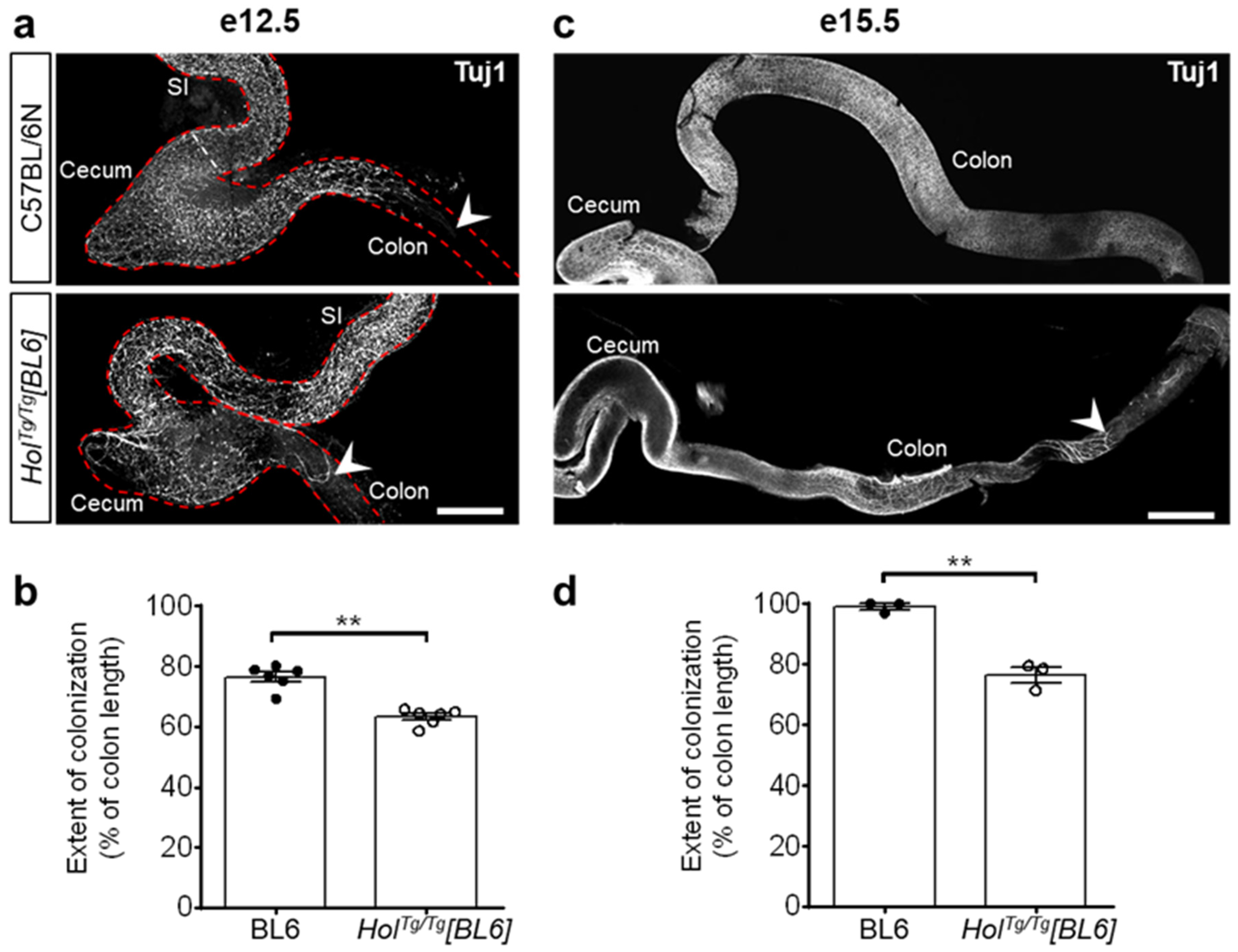 Ijms 22 13140 g003 550