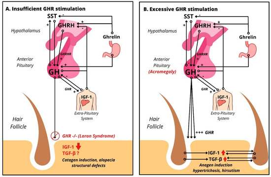 IJMS | Free Full-Text | Growth Hormone and the Human Hair Follicle IJMS | Free Full-Text | Growth Hormone and the Human Hair Follicle
