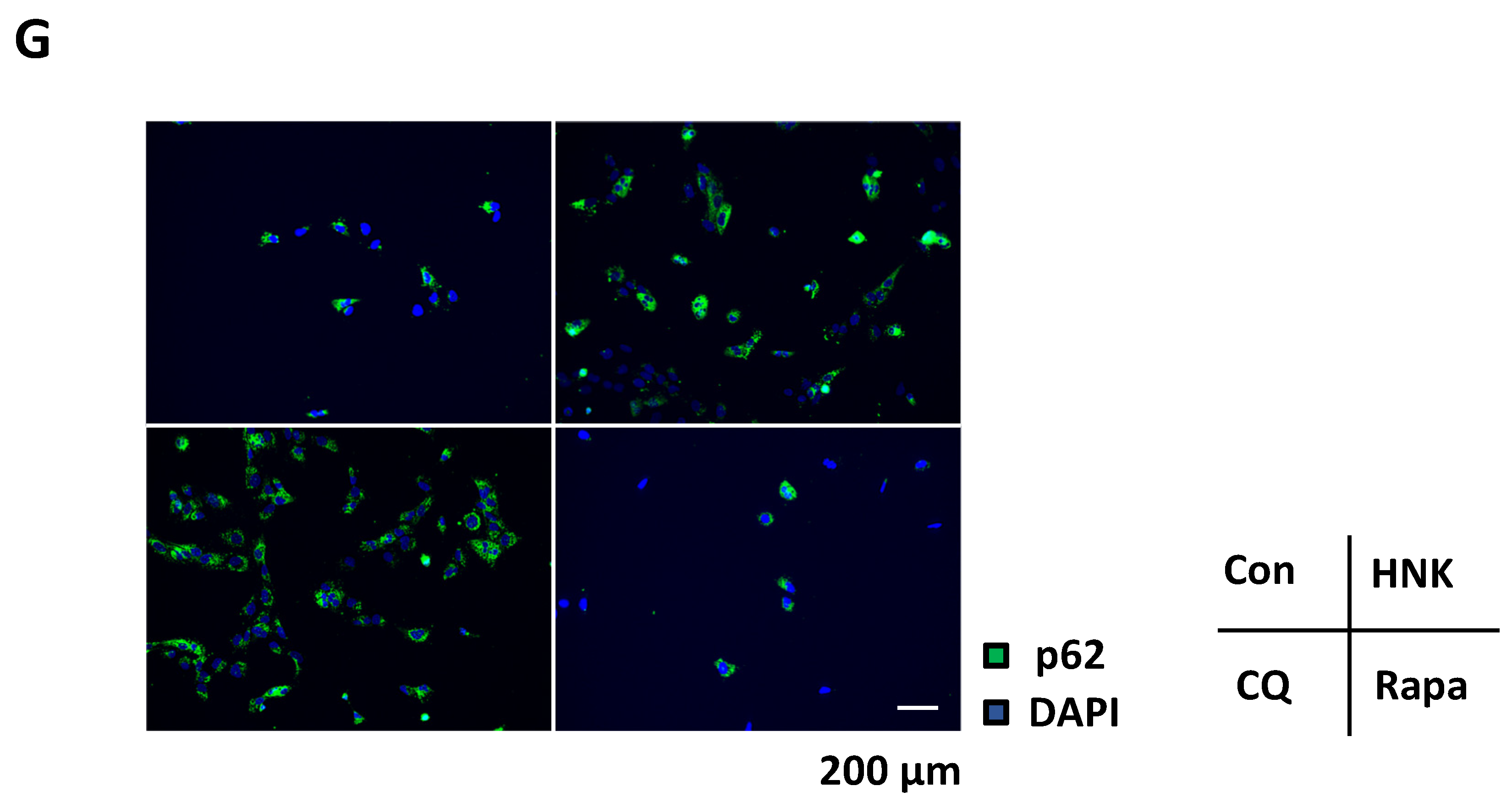 Ijms 22 13354 g005b 550