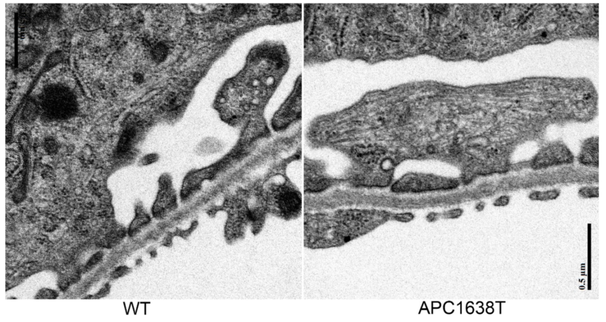 IJMS Free FullText Decreased Podocyte Vesicle Transcytosis and