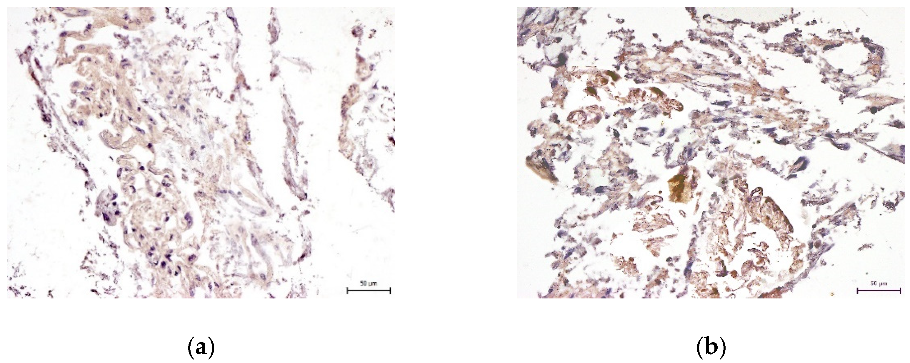 Ijms 22 13515 g009 550