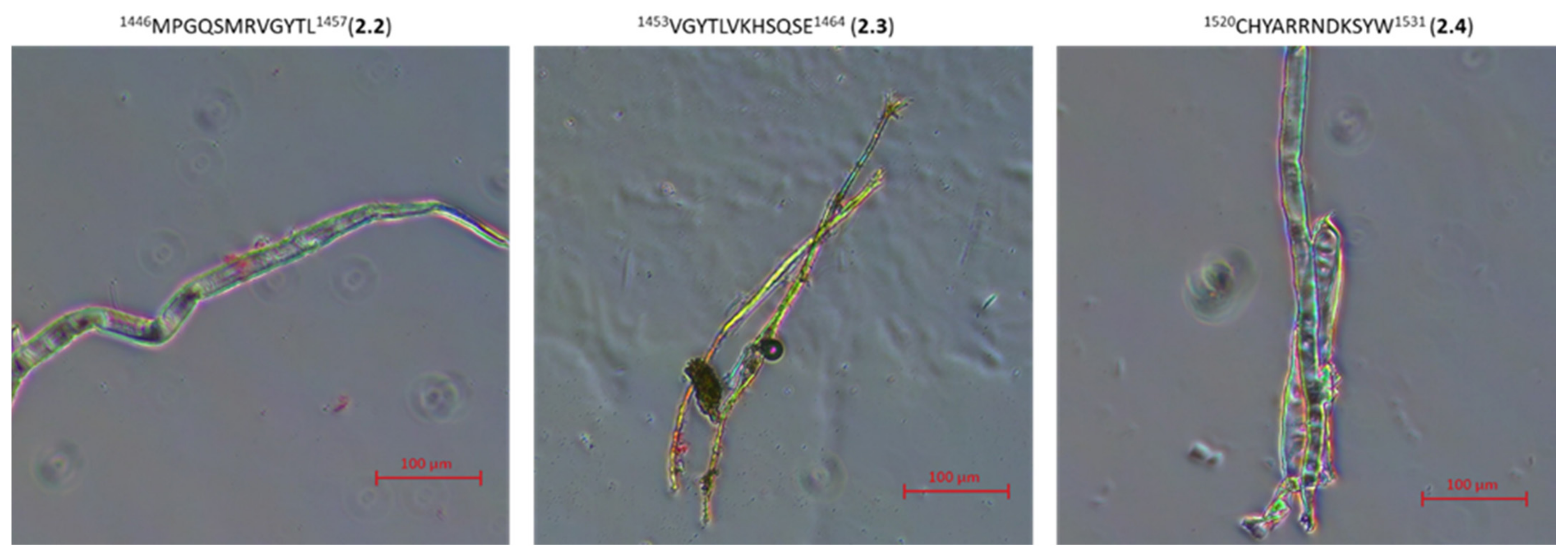 Ijms 22 13584 g012b 550