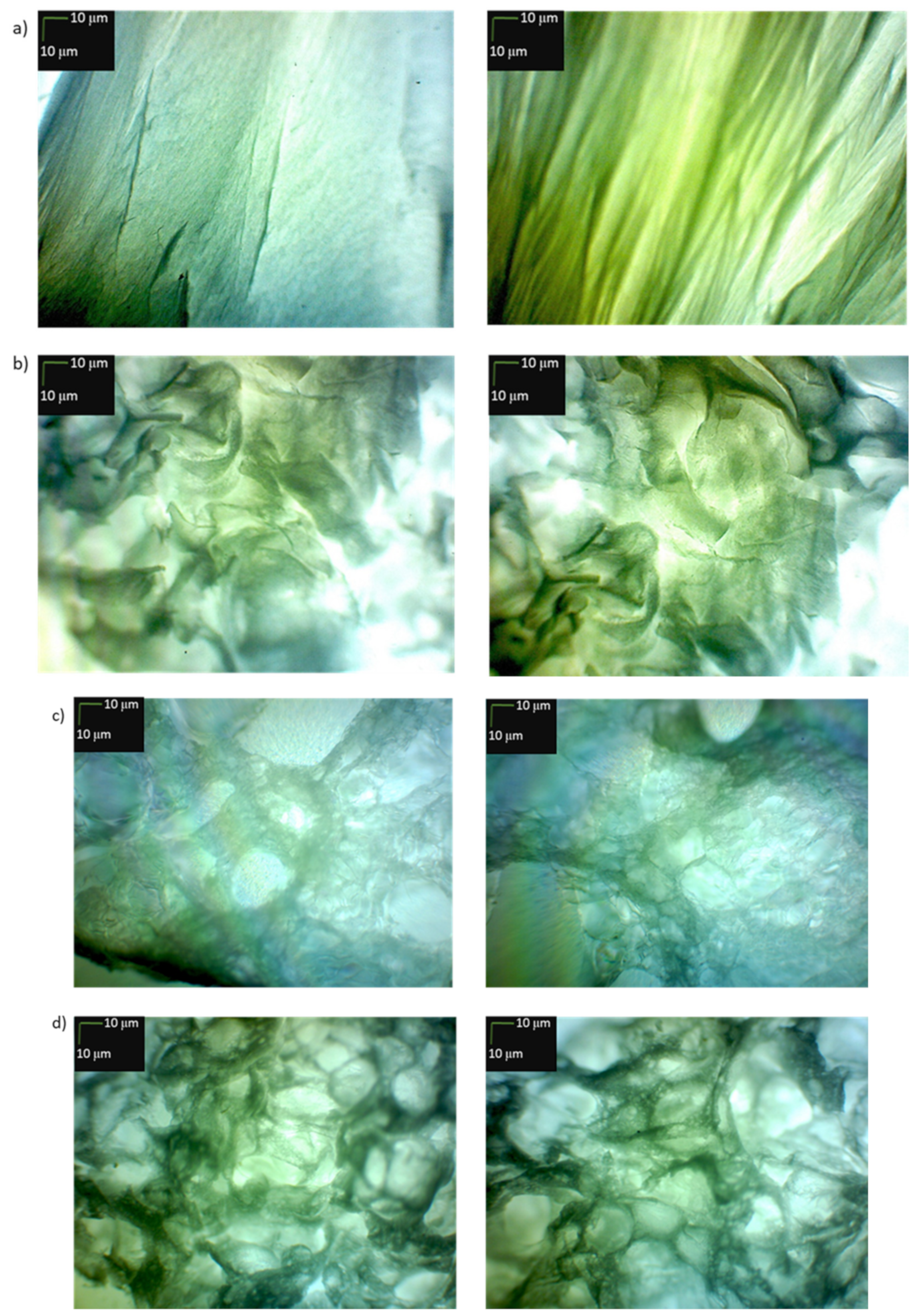 Ijms 22 13584 g017a 550