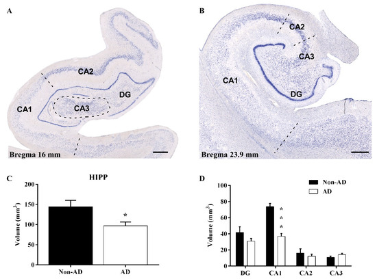 Neurodegeneration and Astrogliosis in the Human CA1 Hippocampal ...
