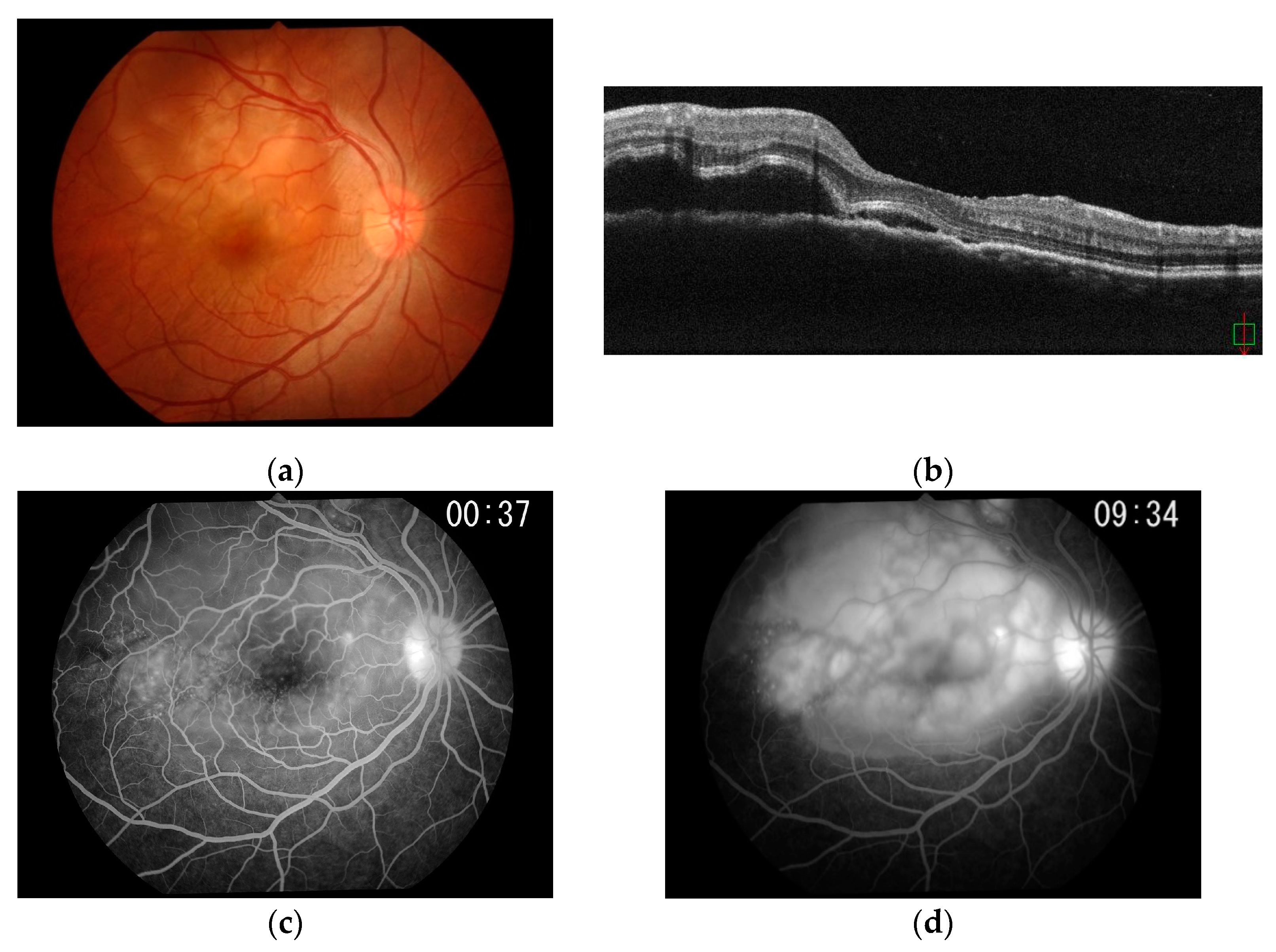 Ijms 23 00341 g005 Ijms 23 00341 g005