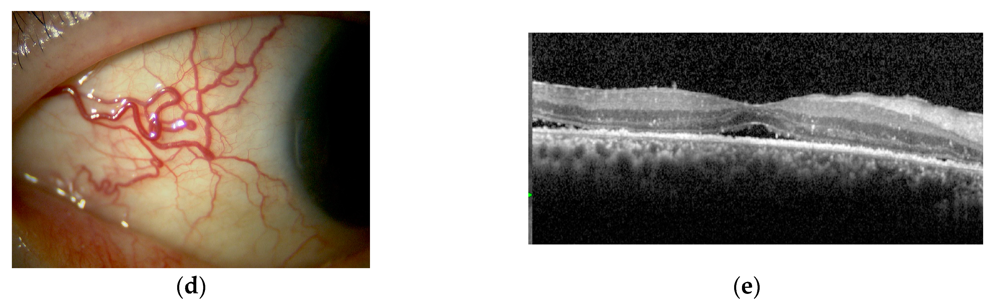 Ijms 23 00341 g008b Ijms 23 00341 g008b