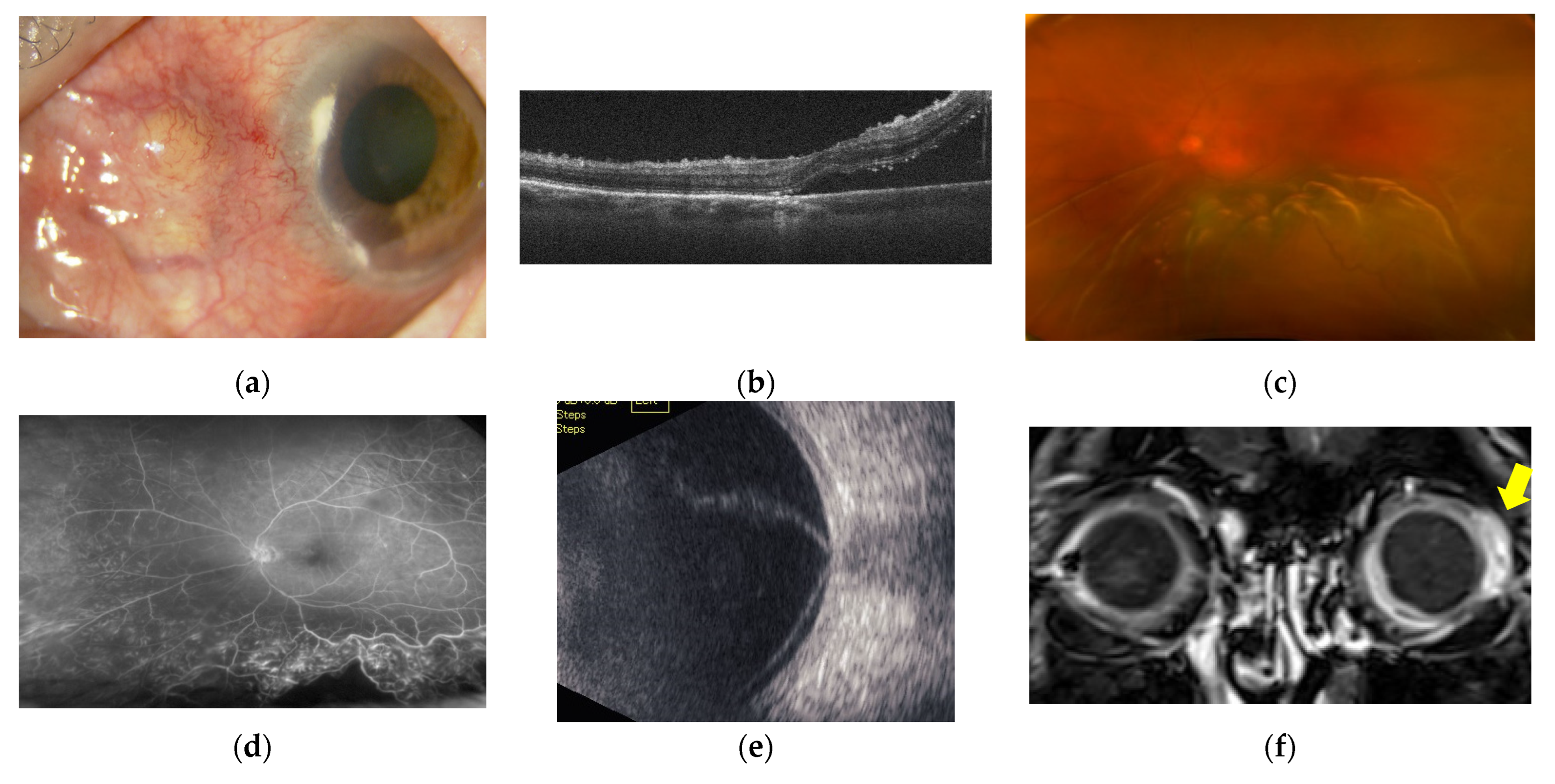 Ijms 23 00341 g009 Ijms 23 00341 g009