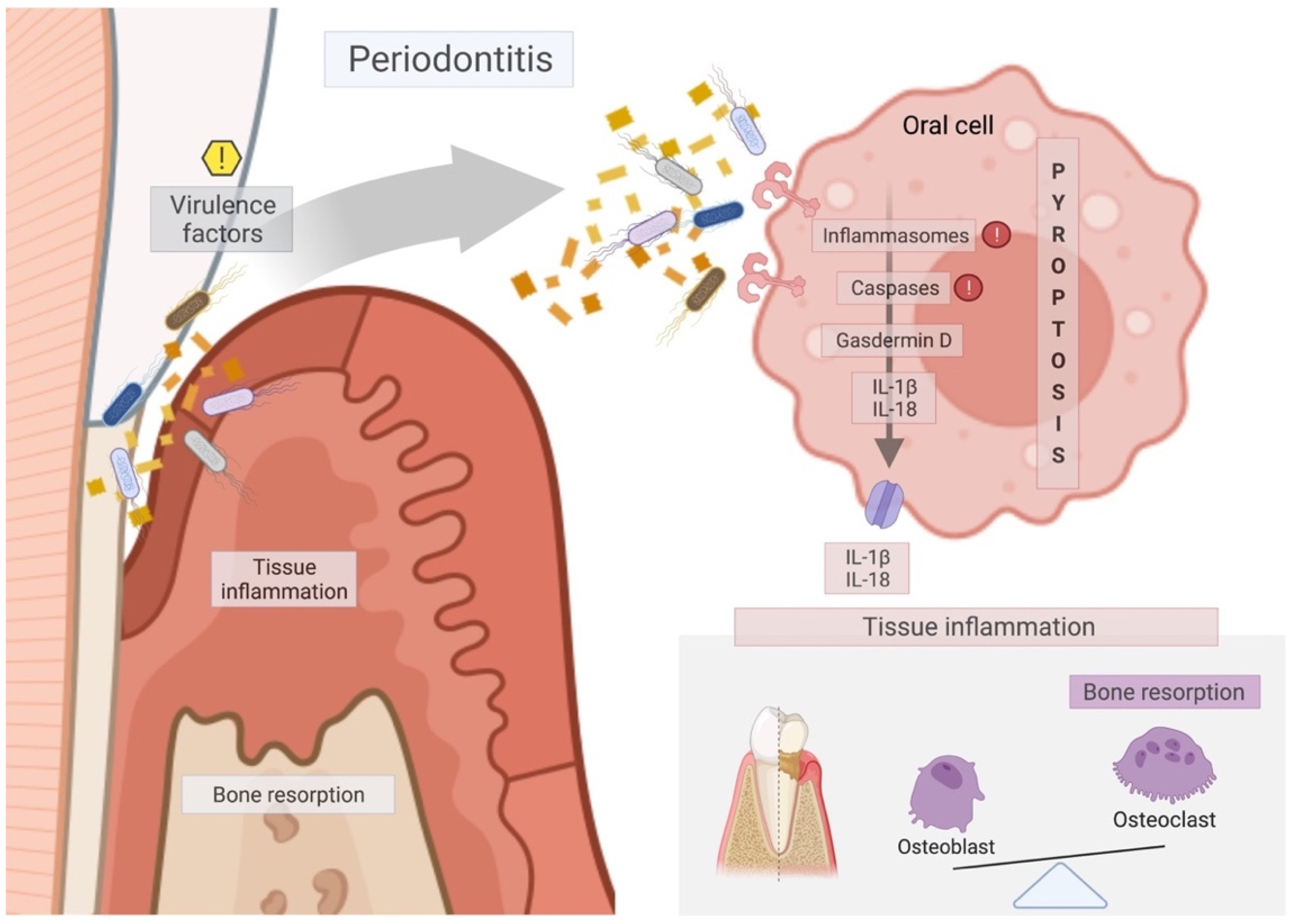ペリオドンタル・デブライドメント = Periodontal debridem… Concaved Periotome - TBS Dental