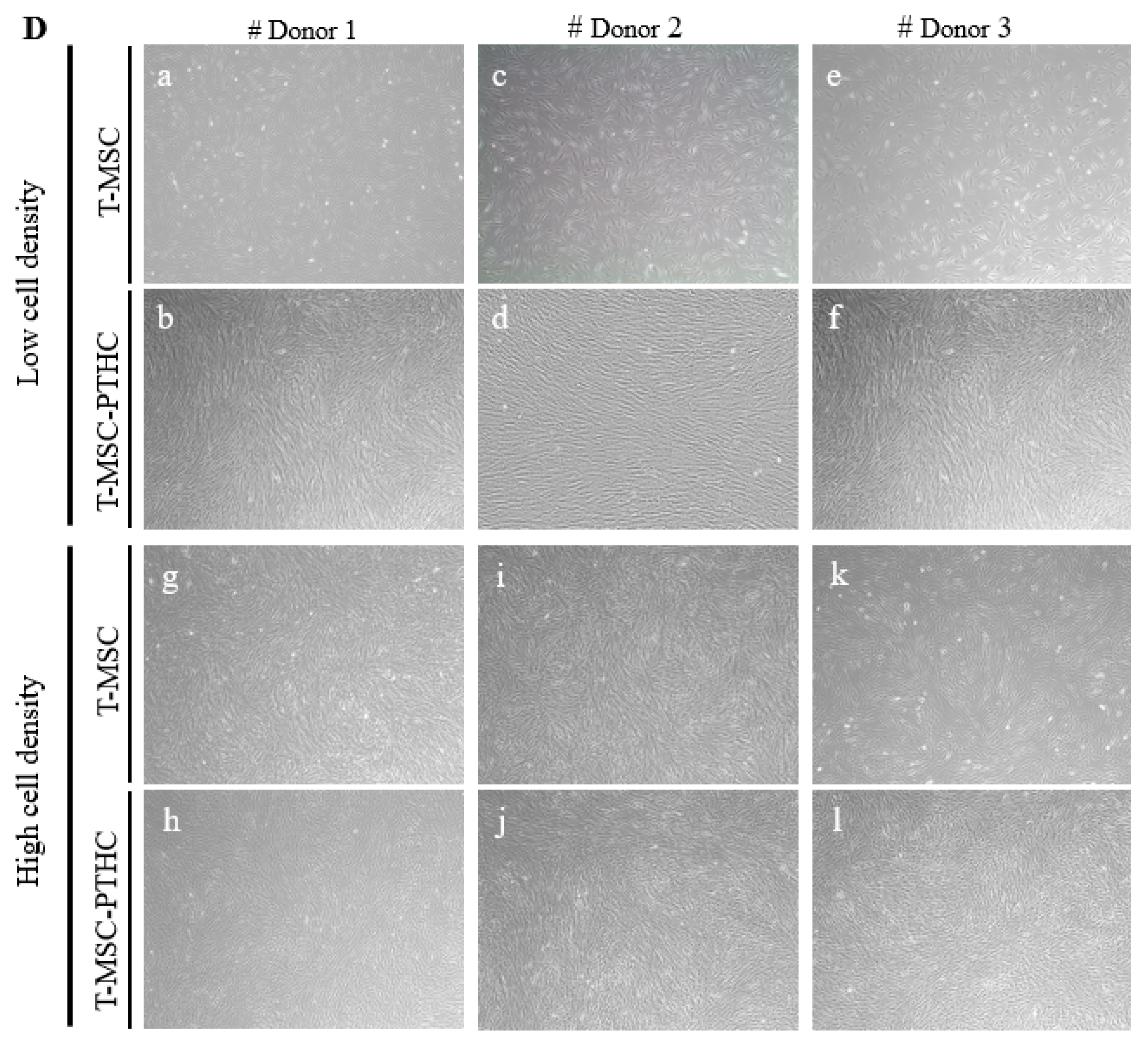 IJMS | Free Full-Text | Density-Dependent Differentiation of Tonsil-Derived  Mesenchymal Stem Cells into Parathyroid-Hormone-Releasing Cells