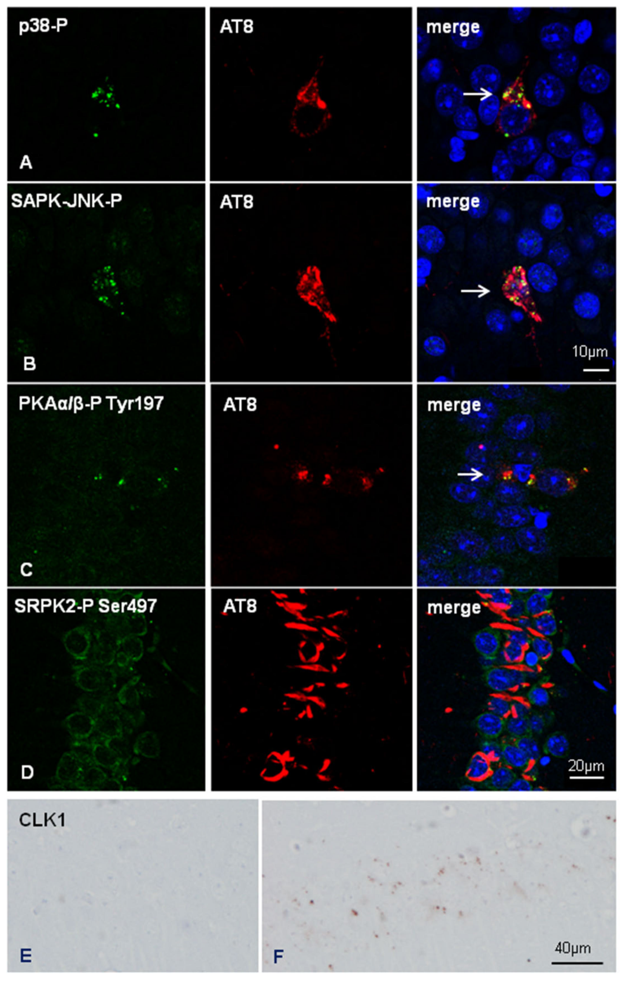 Ijms 23 00718 g007 550