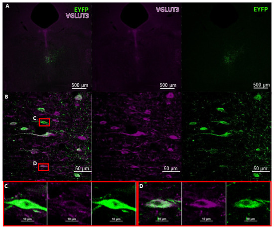 A New Player in the Hippocampus: A Review on VGLUT3+ Neurons and