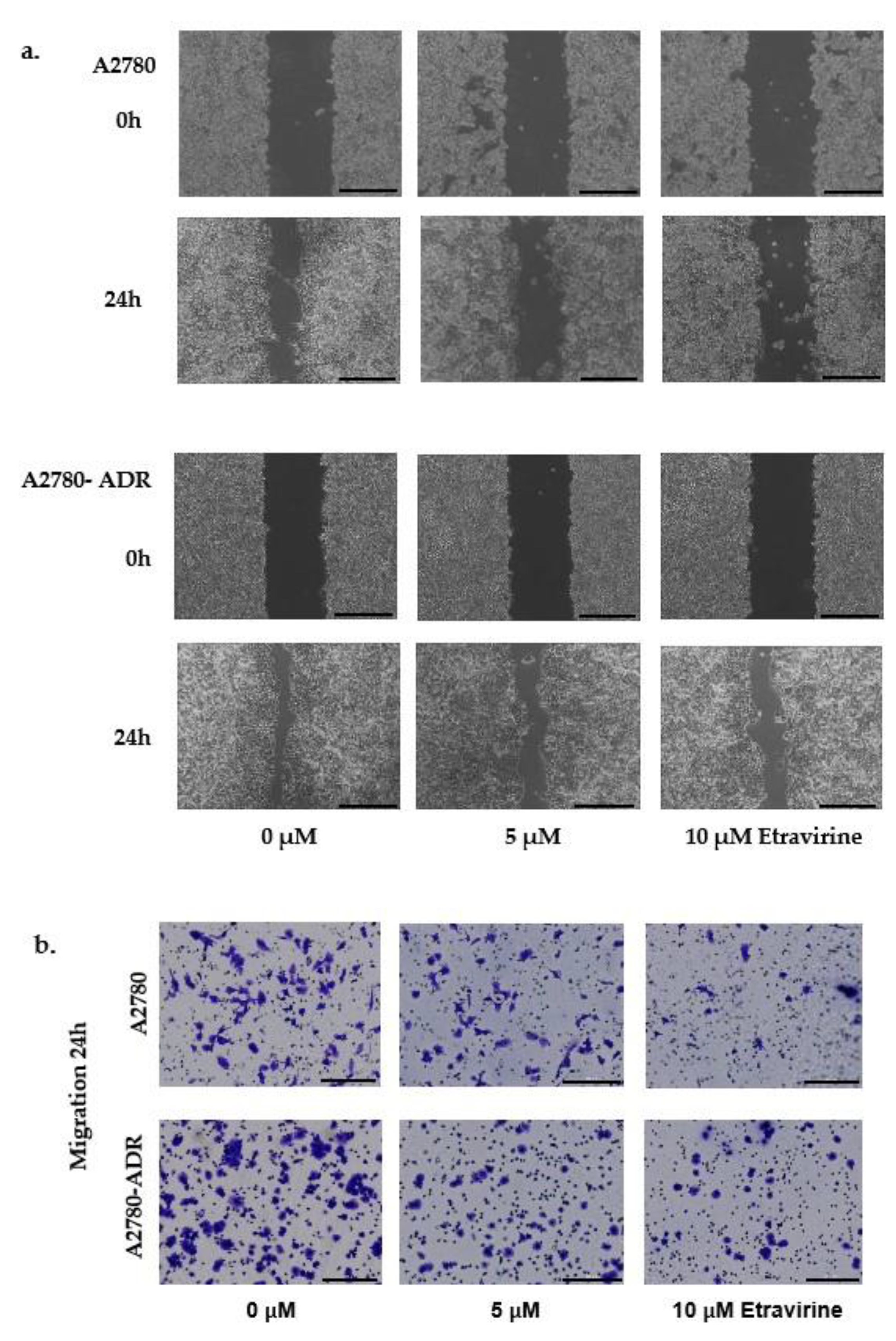 Ijms 23 00944 g005a 550