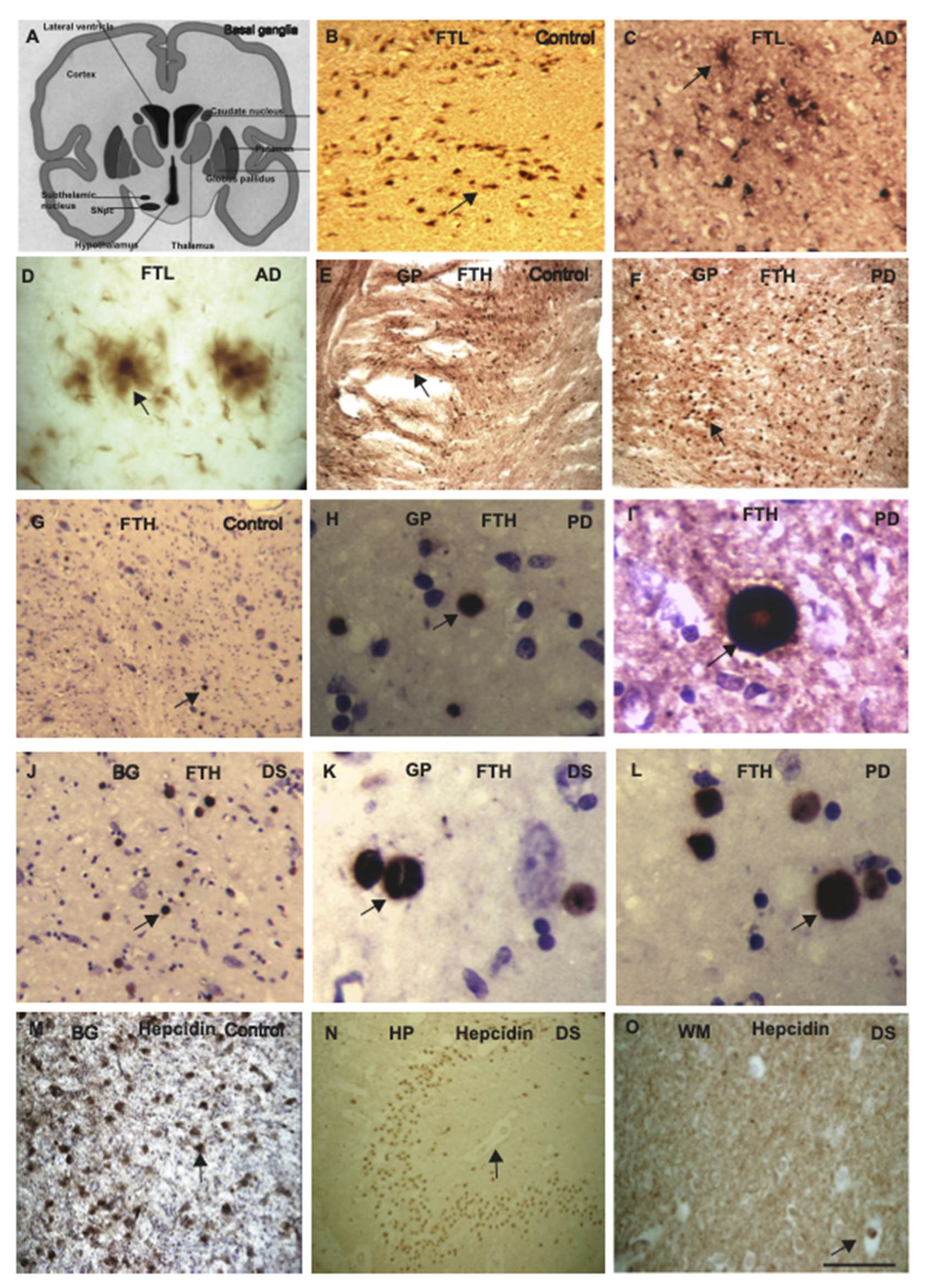 Ijms 23 01060 g004 Ijms 23 01060 g004