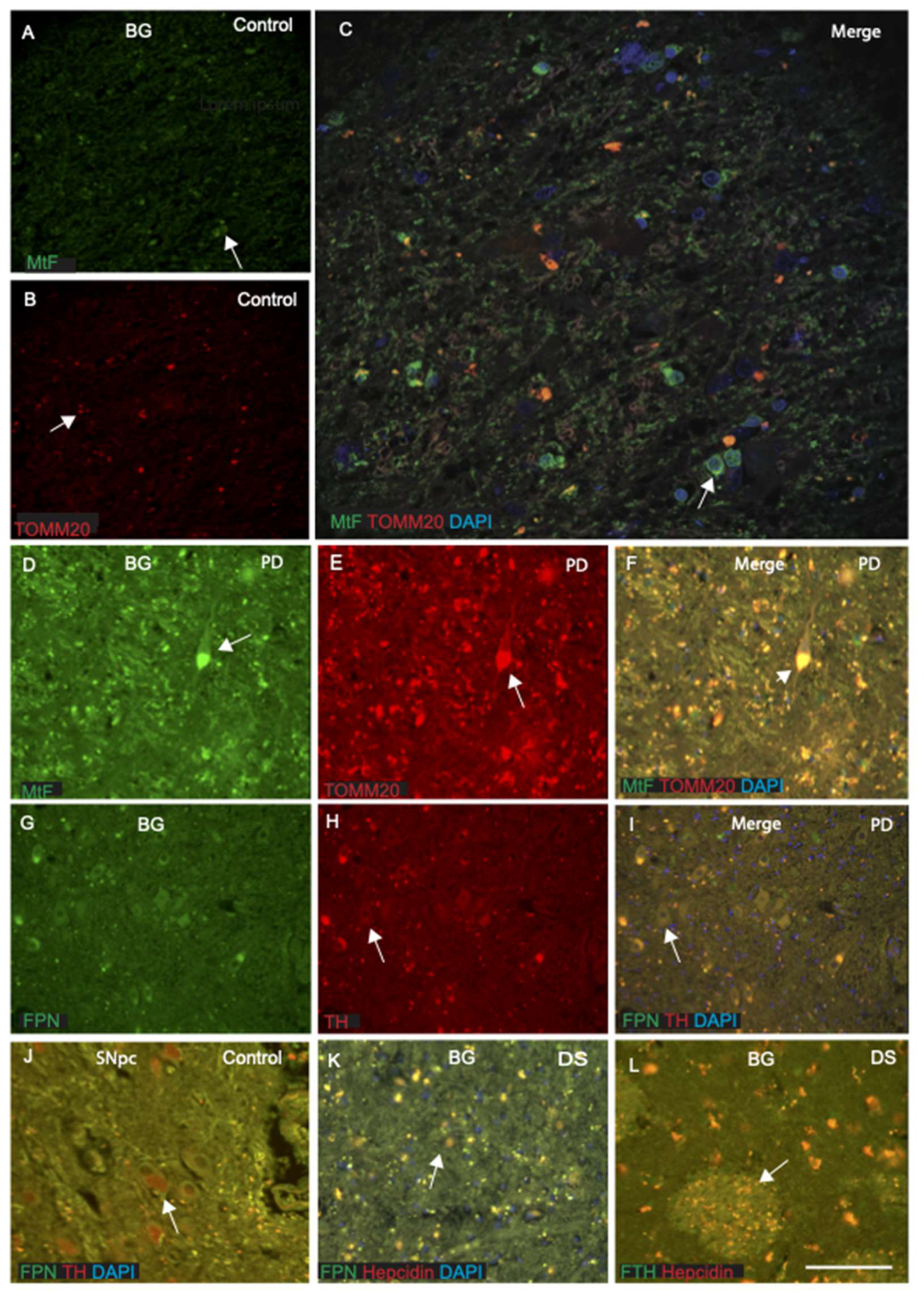 Ijms 23 01060 g007 Ijms 23 01060 g007