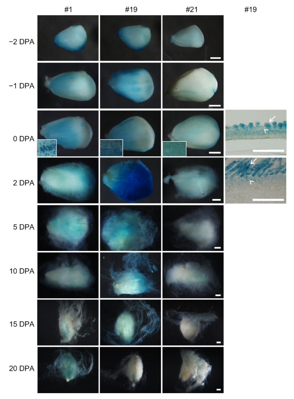 Ijms 23 01087 g004 550