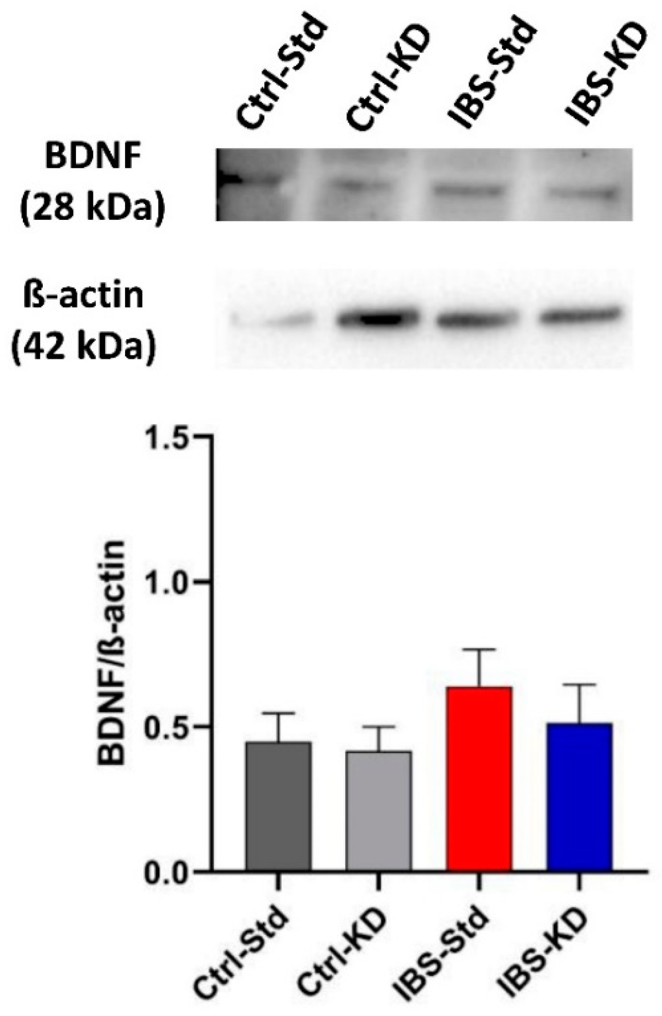 Ijms 23 01098 g004 550