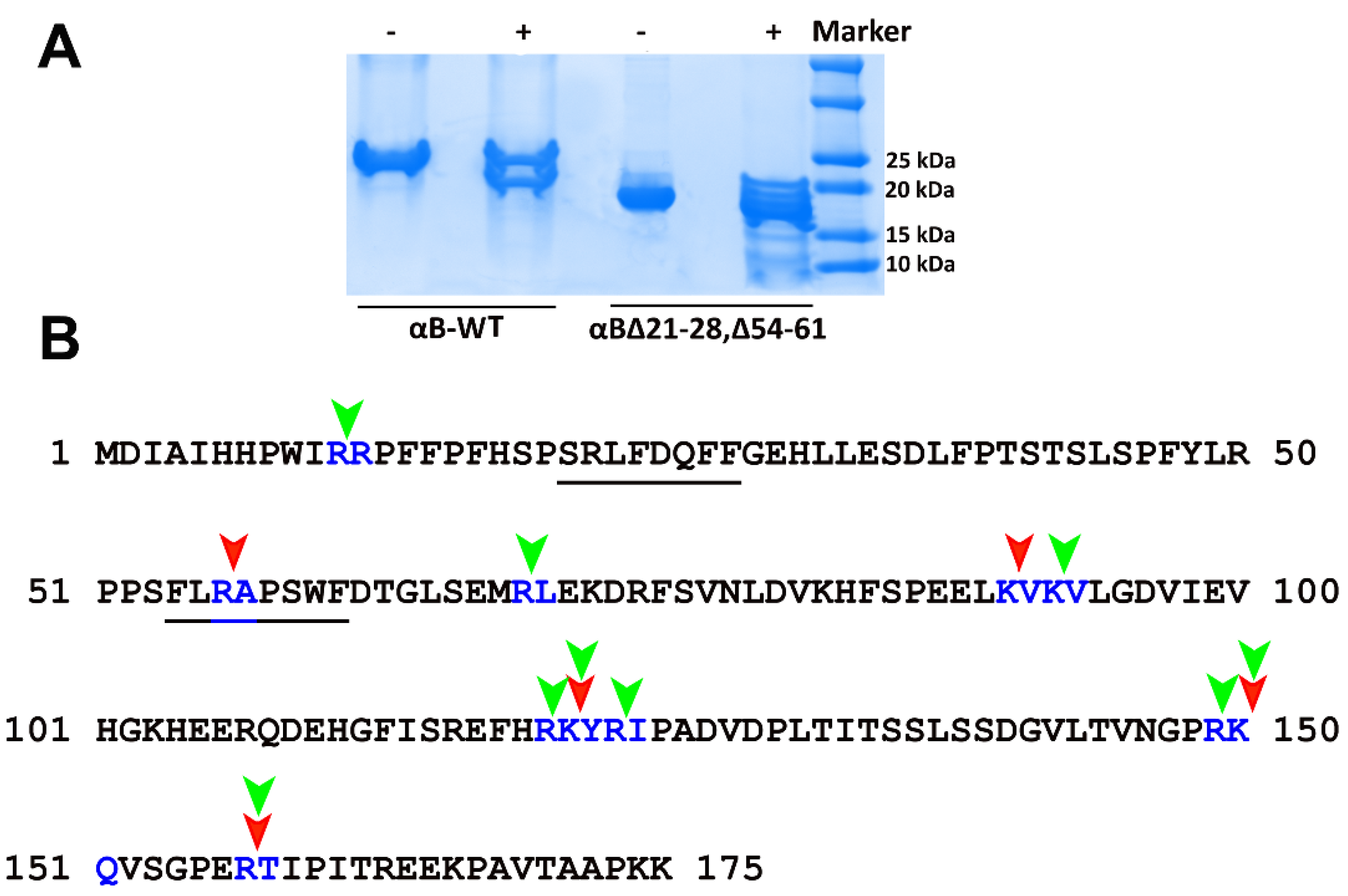 Ijms 23 01099 g005 Ijms 23 01099 g005