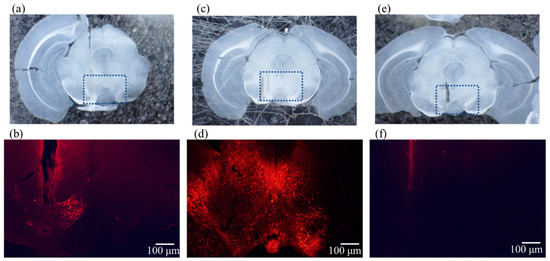 ドーパミン Investigating the Influence of GABA Neurons on Dopamine