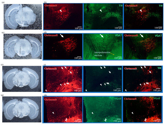Investigating the Influence of GABA Neurons on Dopamine