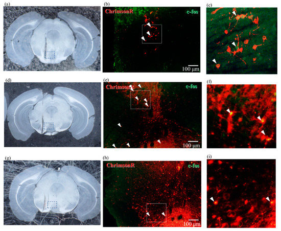 ドーパミン Investigating the Influence of GABA Neurons on Dopamine