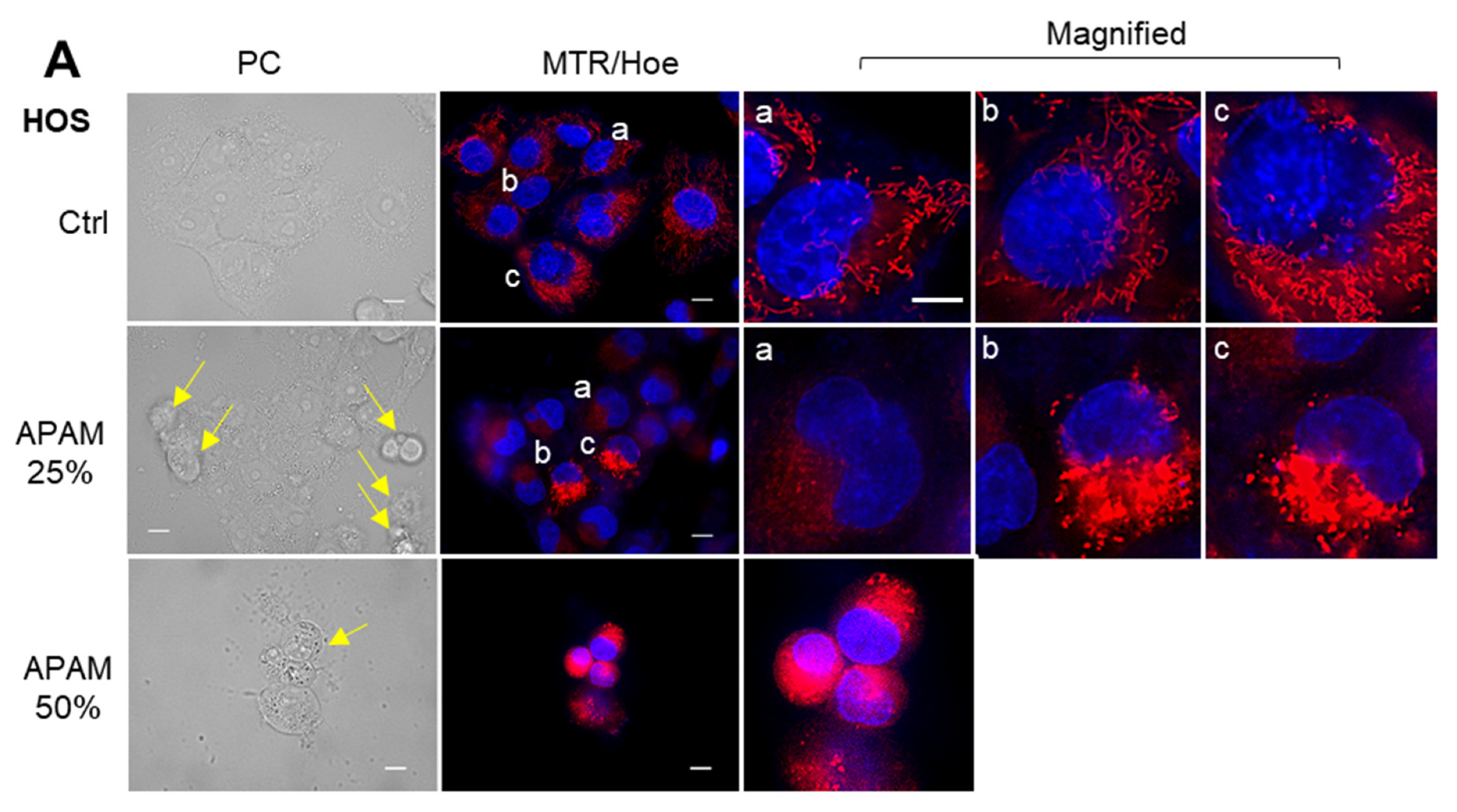 Ijms 23 01124 g004a 550