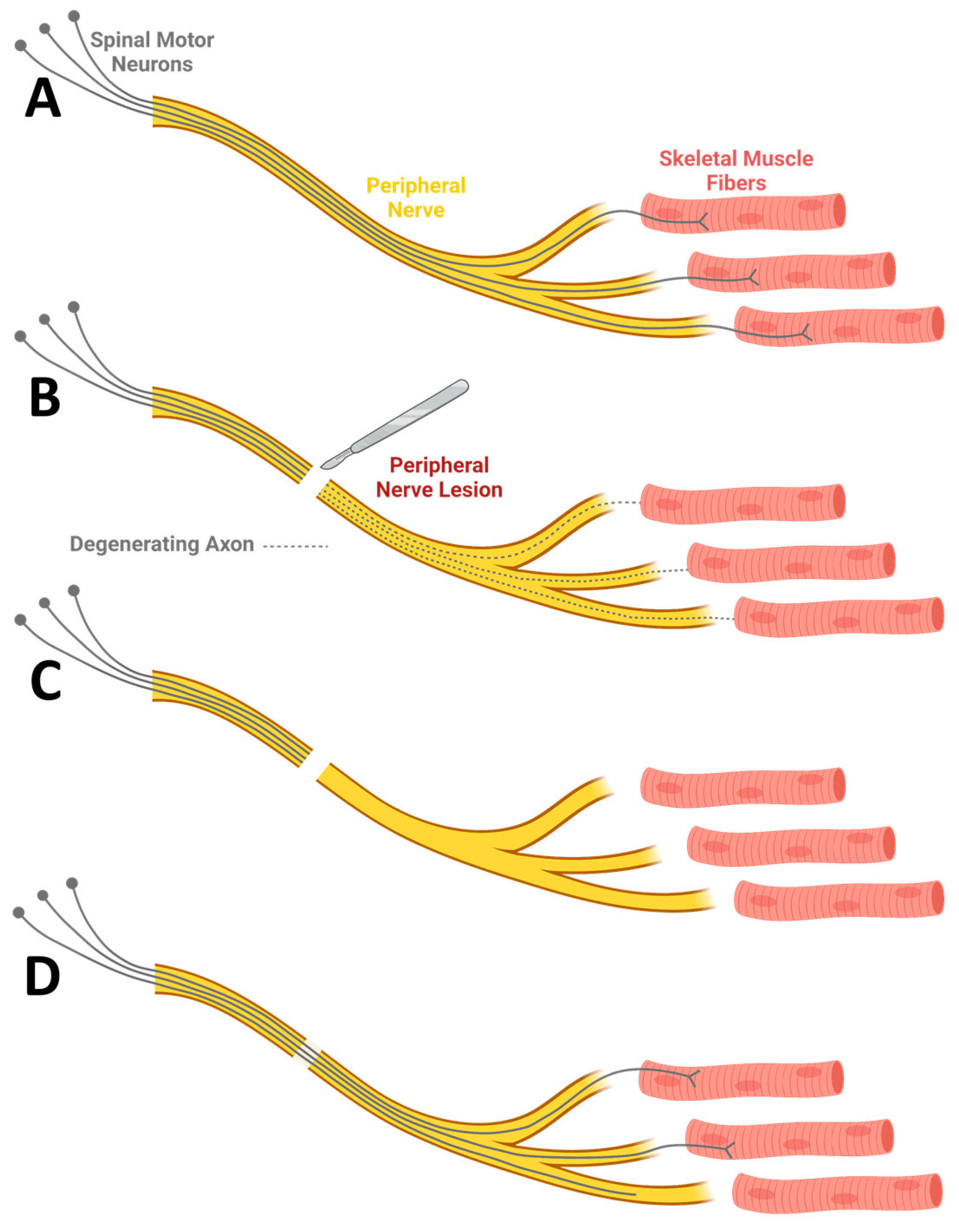 IJMS Free Full Text The Role Of Biomaterials In Peripheral Nerve 