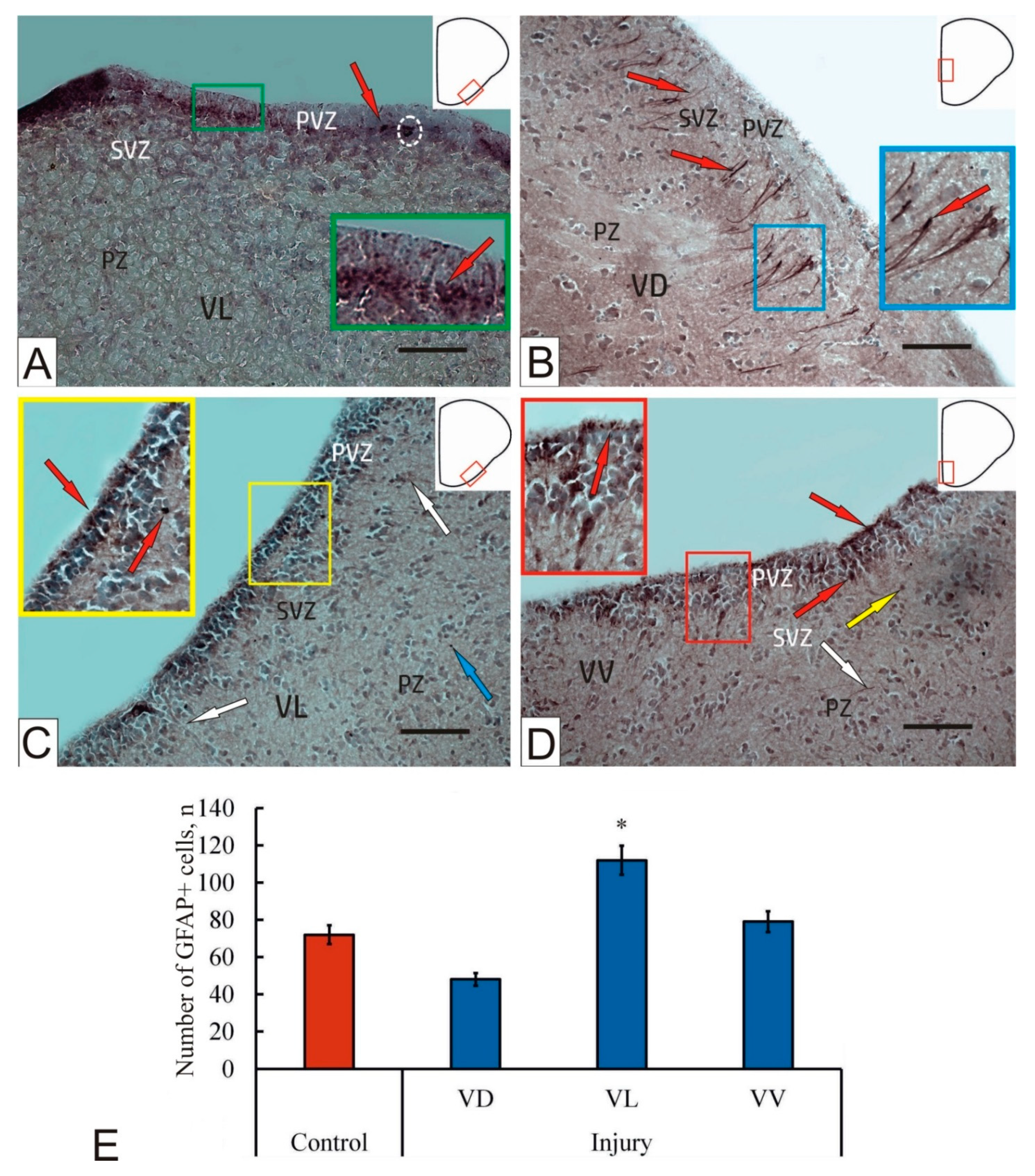 Ijms 23 01334 g002 550