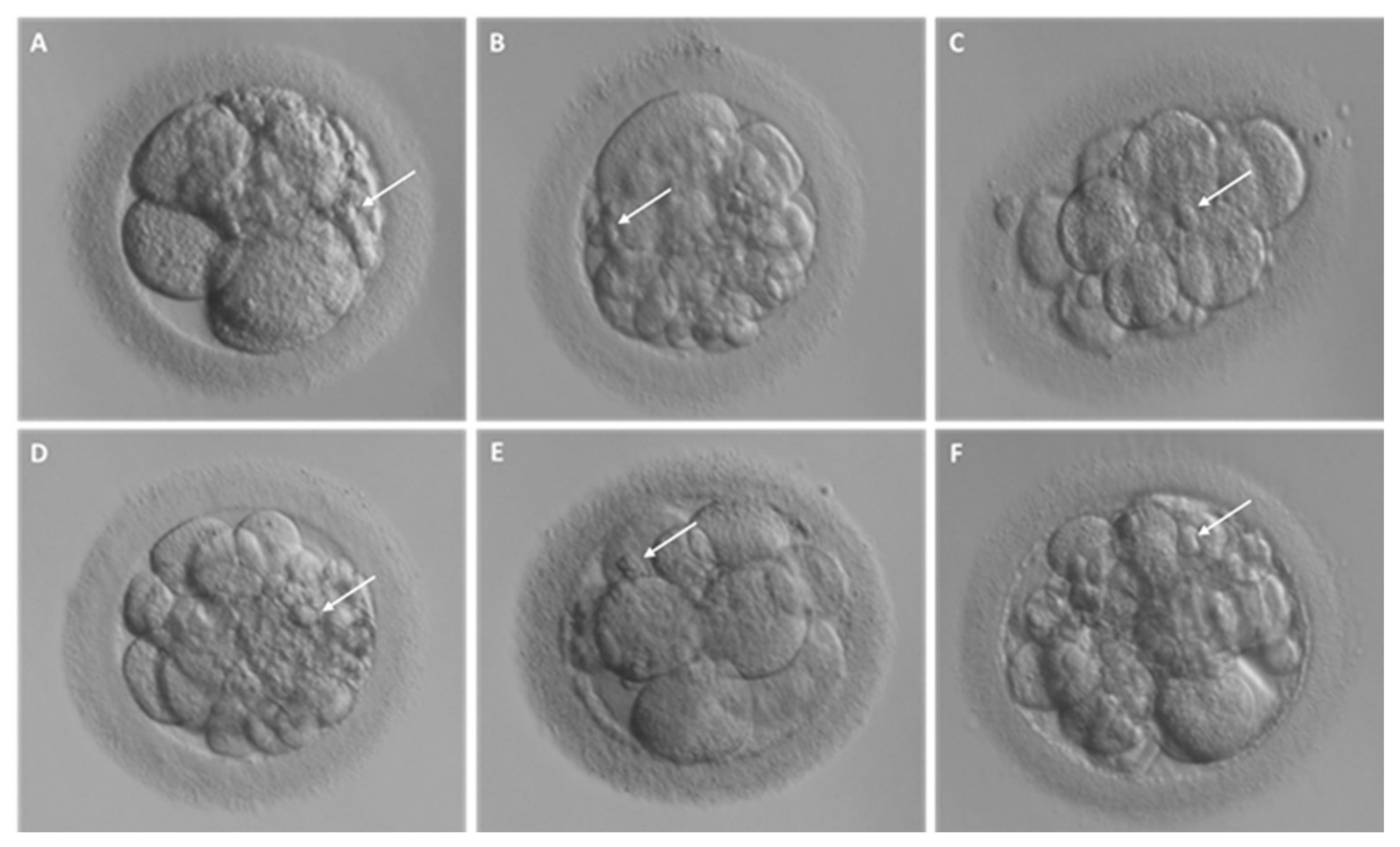 Ijms Free Full Text Cellular And Molecular Nature Of Fragmentation Of Human Embryos Html
