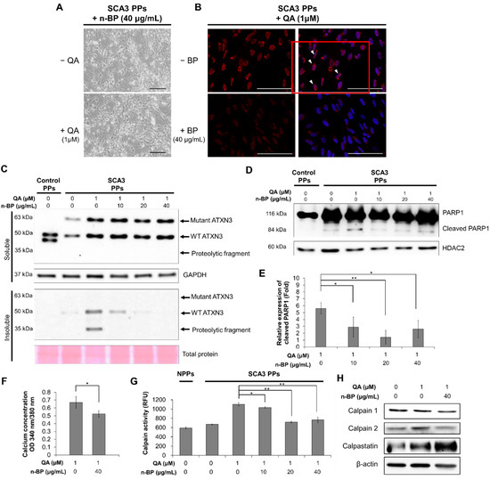 Anti-Excitotoxic Effects of N-Butylidenephthalide Revealed