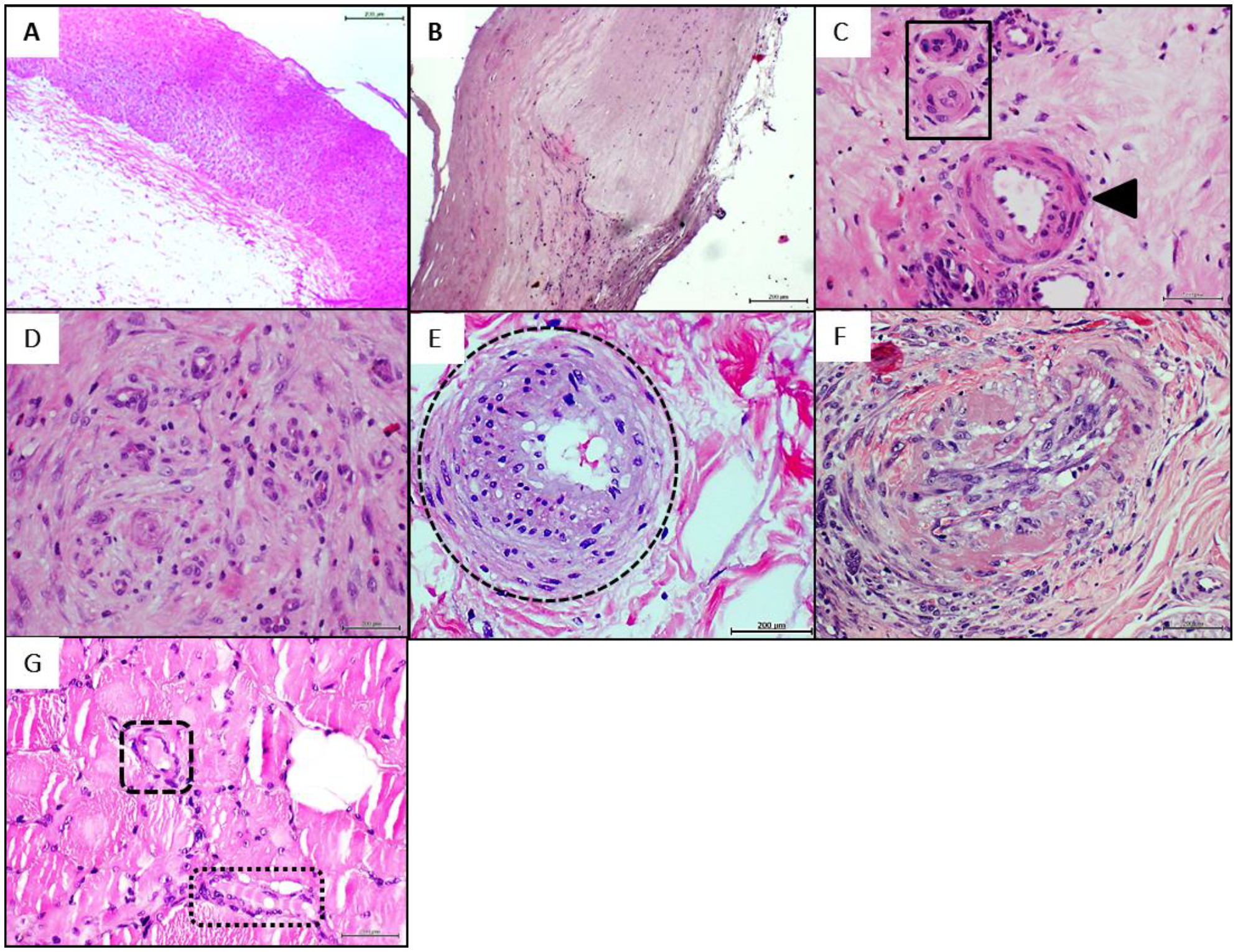 Ijms 23 01511 g001