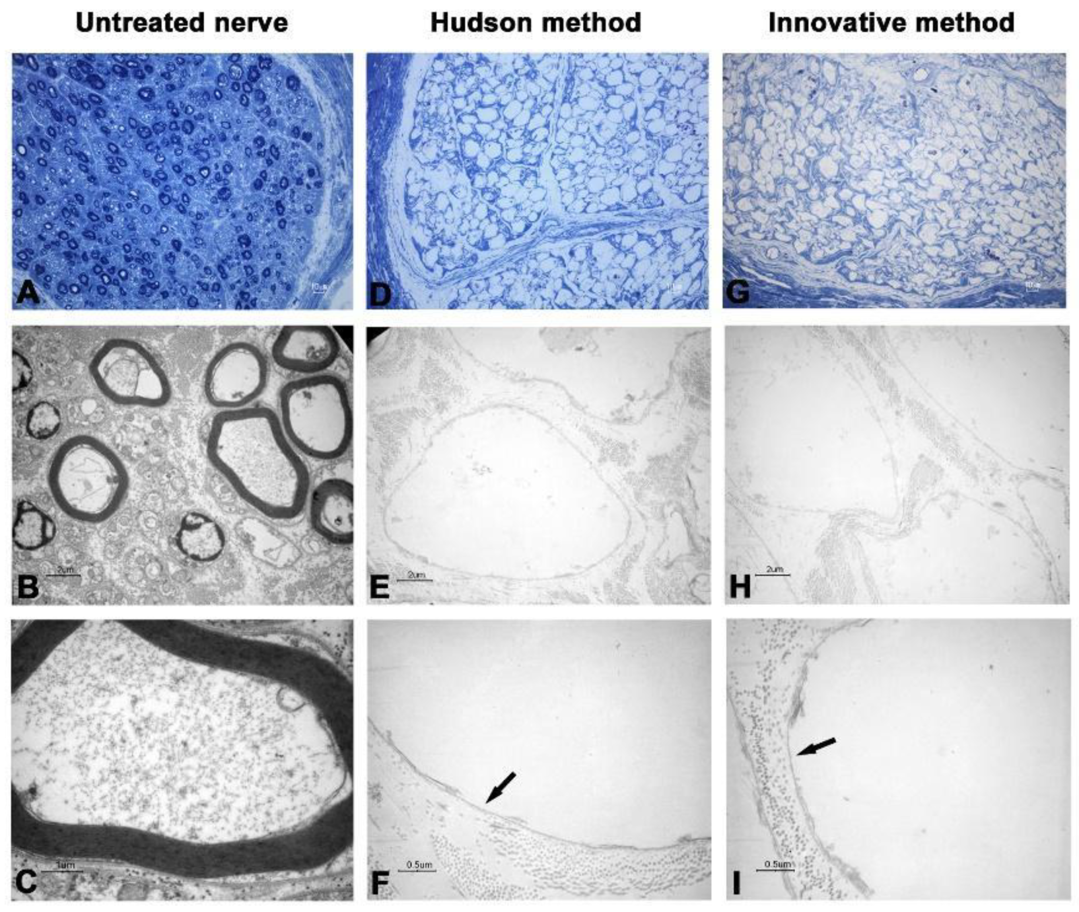 Ijms 23 01530 g005 550