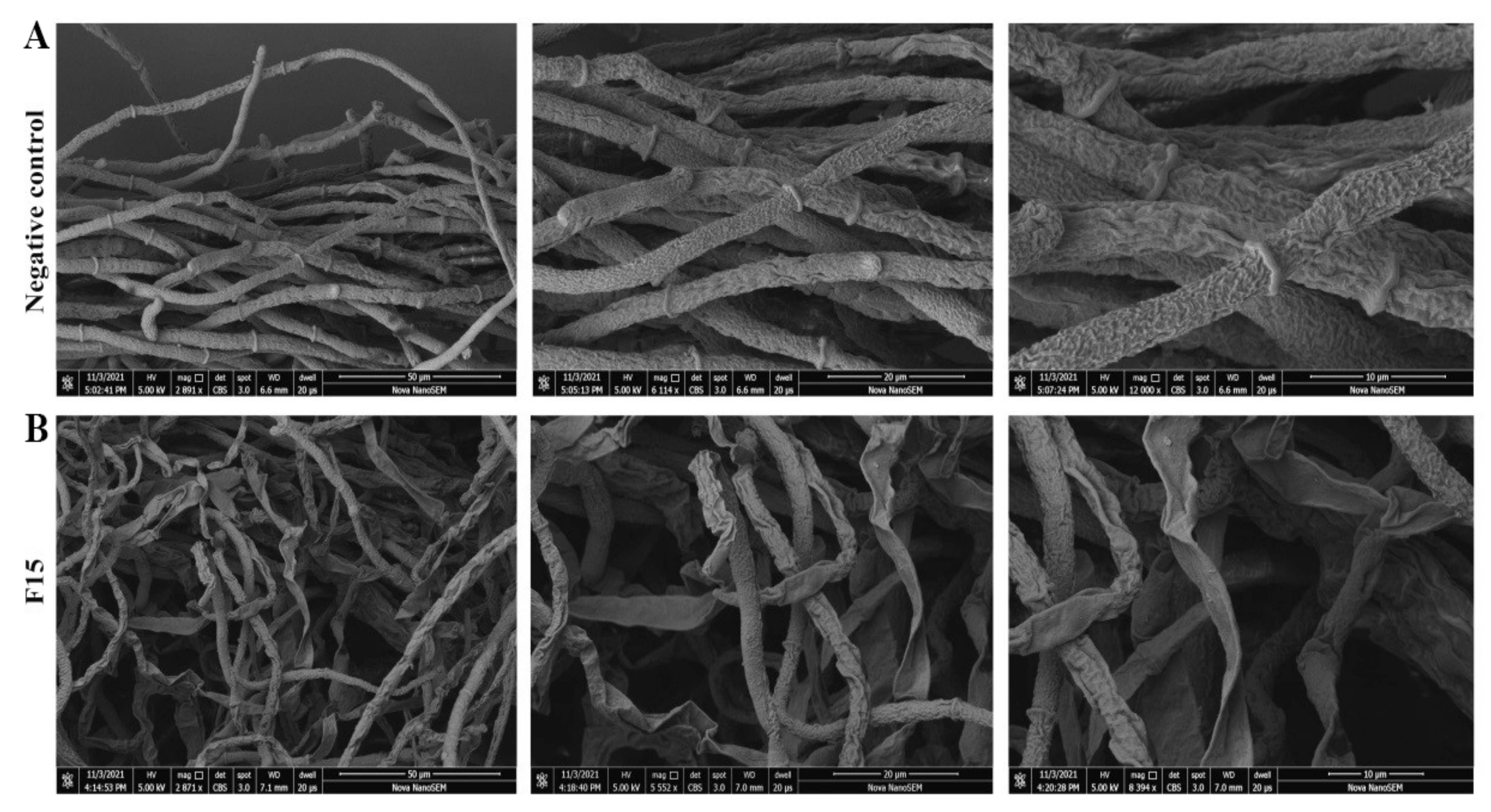 Ijms 23 01596 g005 550