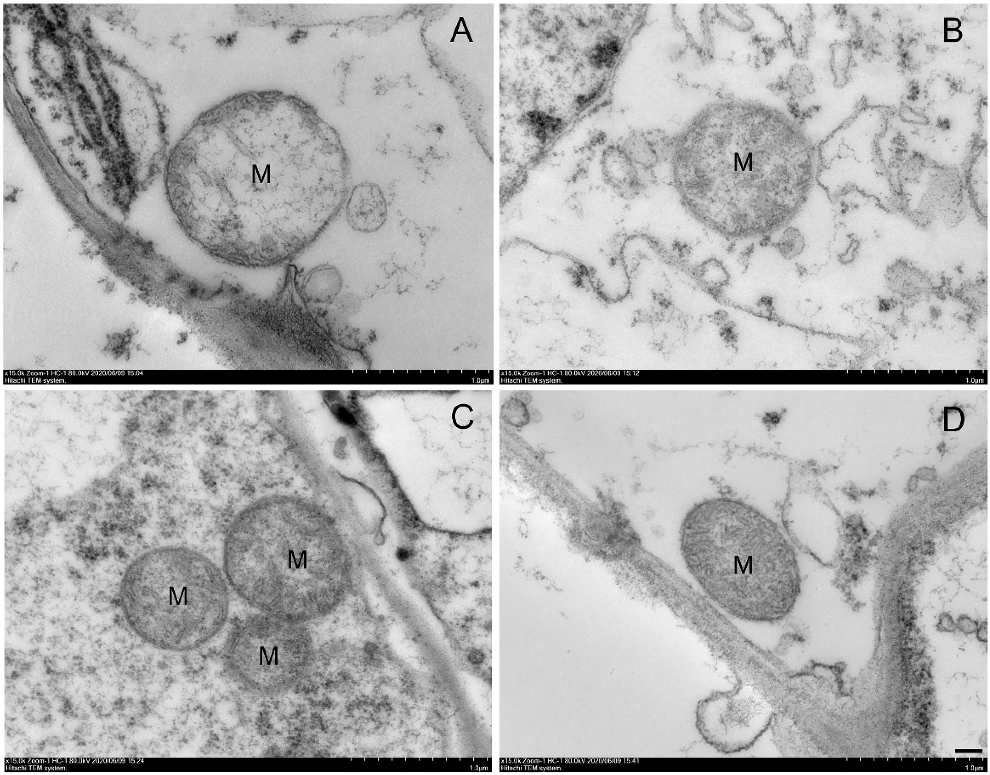 Ijms 23 01607 g004 550