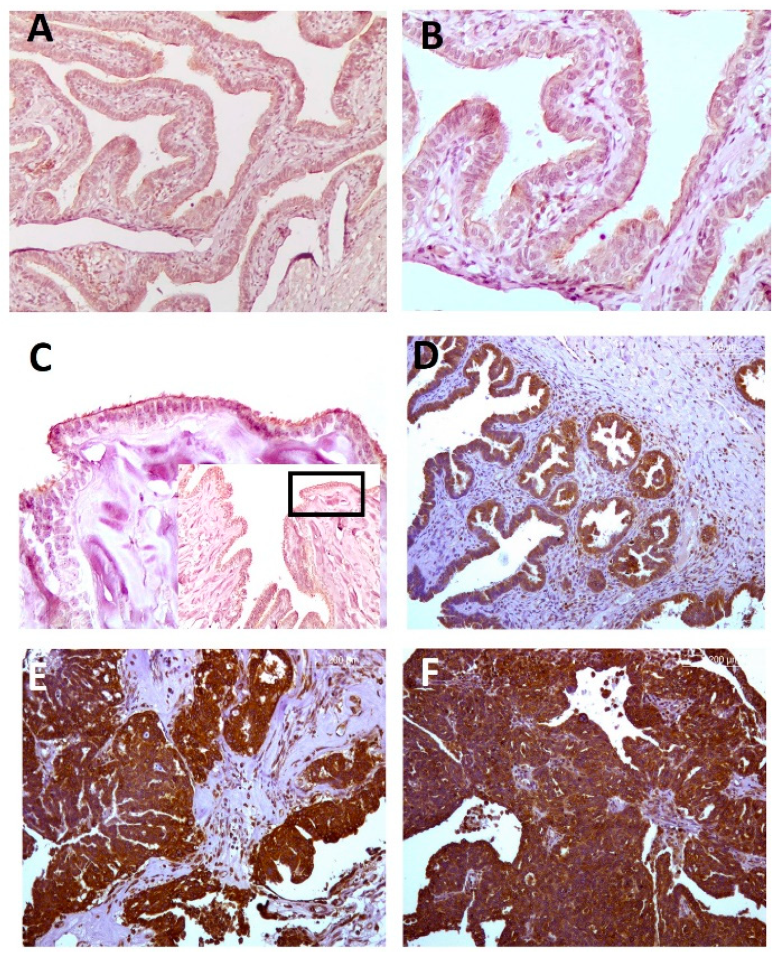 Ijms 23 01742 g001 550