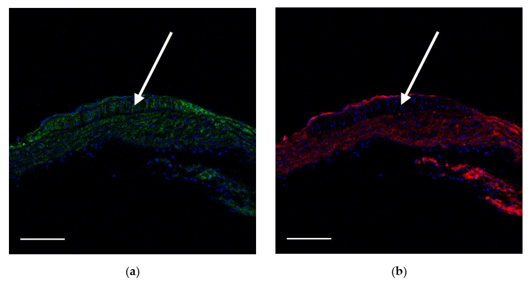Ijms 23 01744 g008a 550