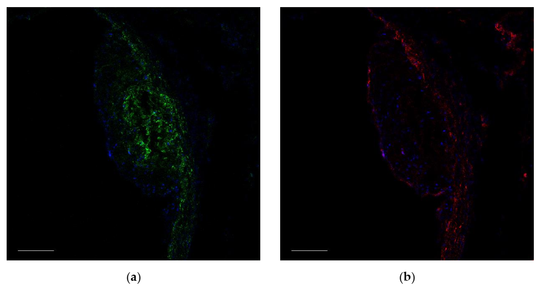 Ijms 23 01744 g009a 550