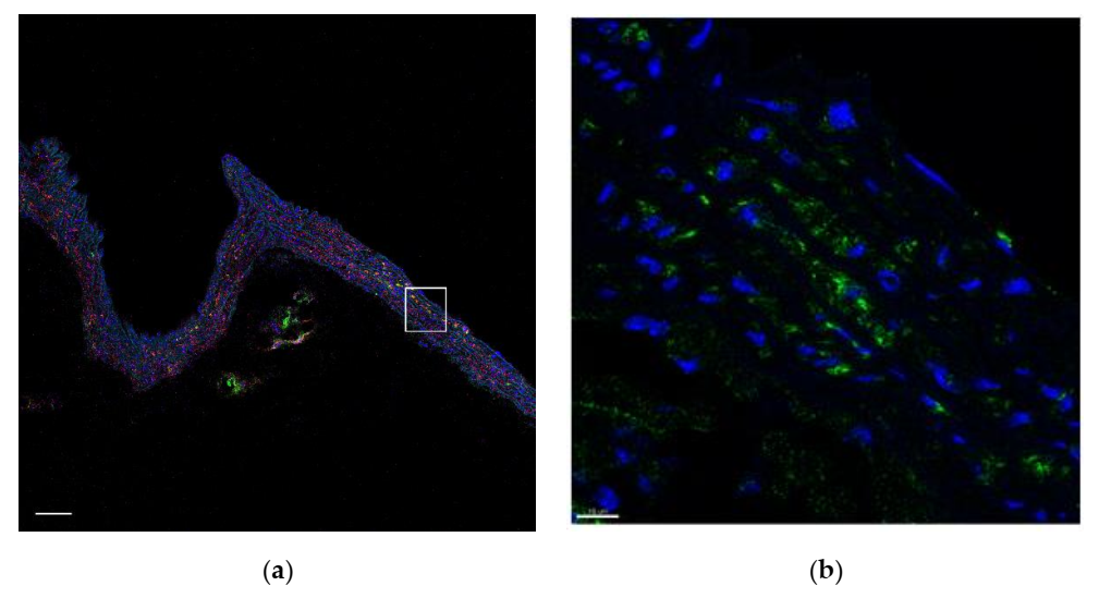 Ijms 23 01744 g010a 550
