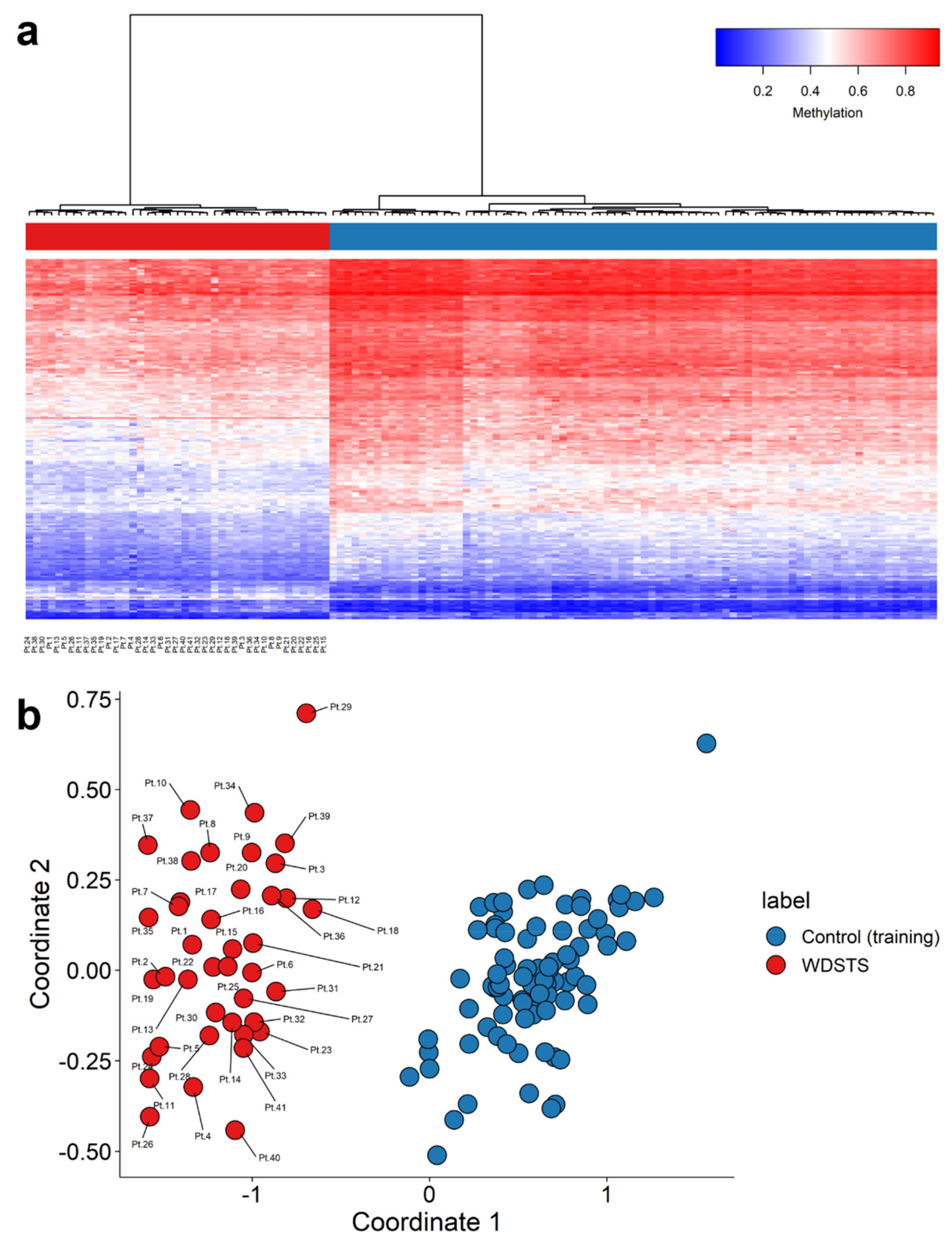 Expanding the phenotype associated to KMT2A variants: overlapping clinical  signs between Wiedemann–Steiner and Rubinstein–Taybi syndromes