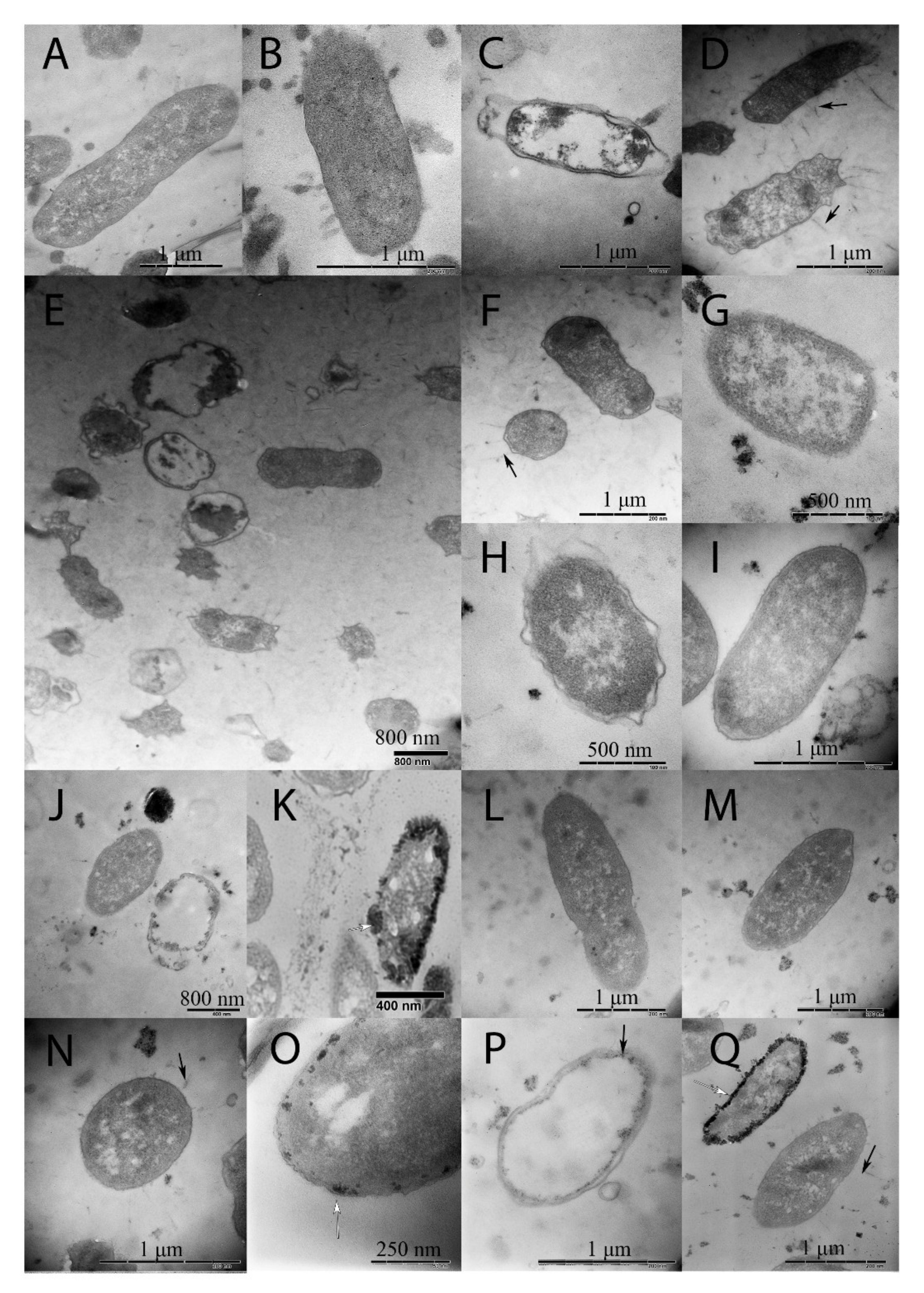 Ijms 23 01837 g003 Ijms 23 01837 g003