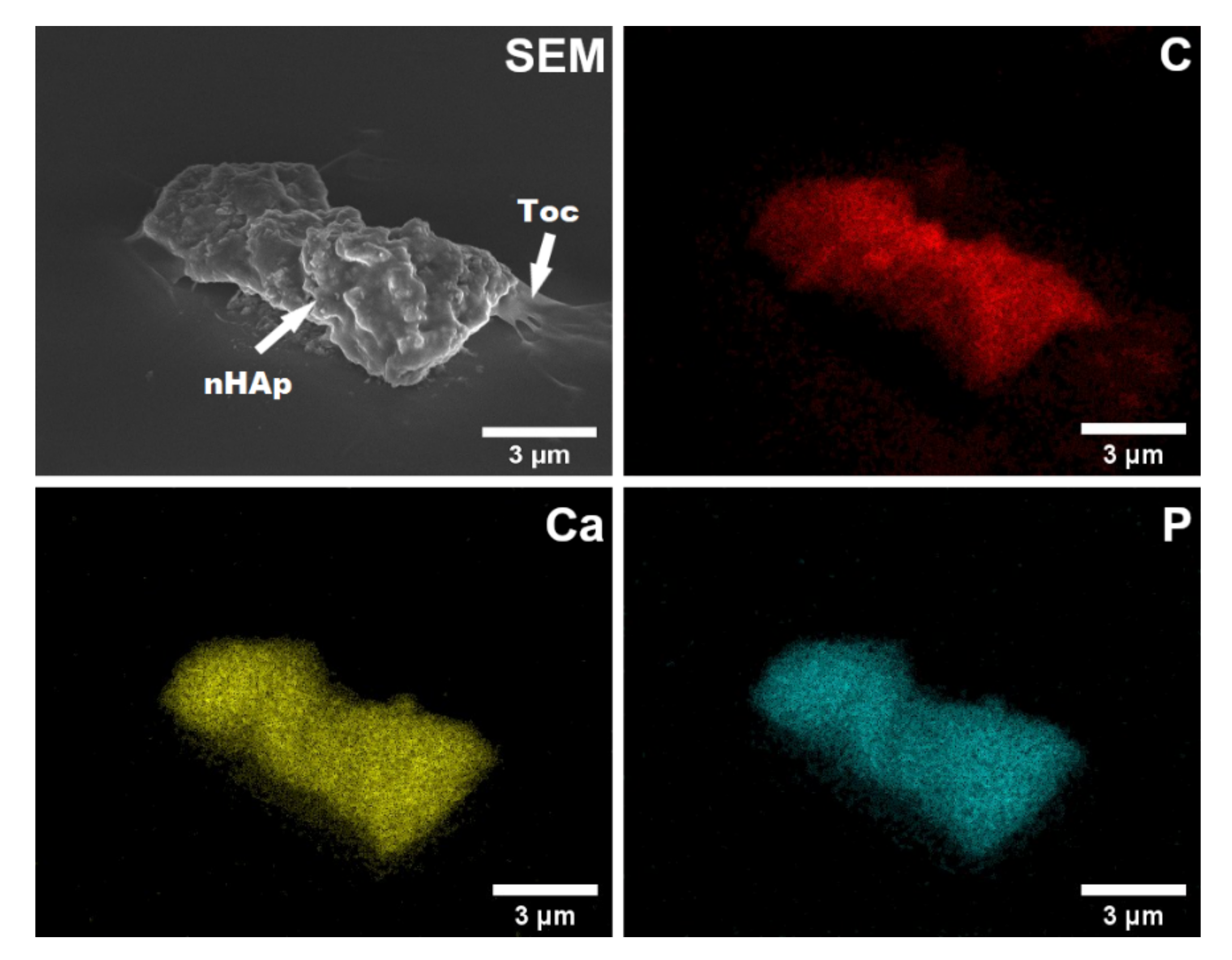 Ijms 23 01944 g004 550