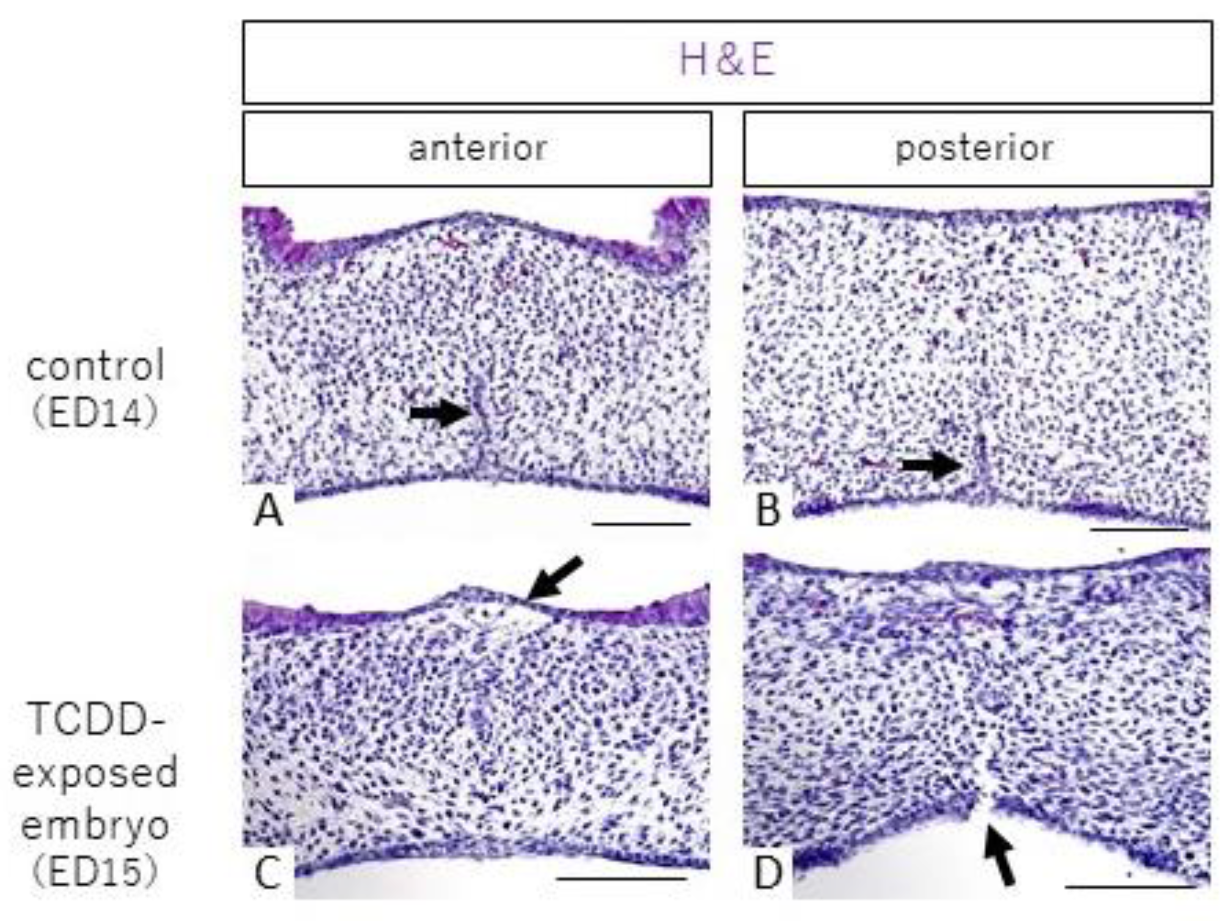 Ijms 23 02069 g001 550